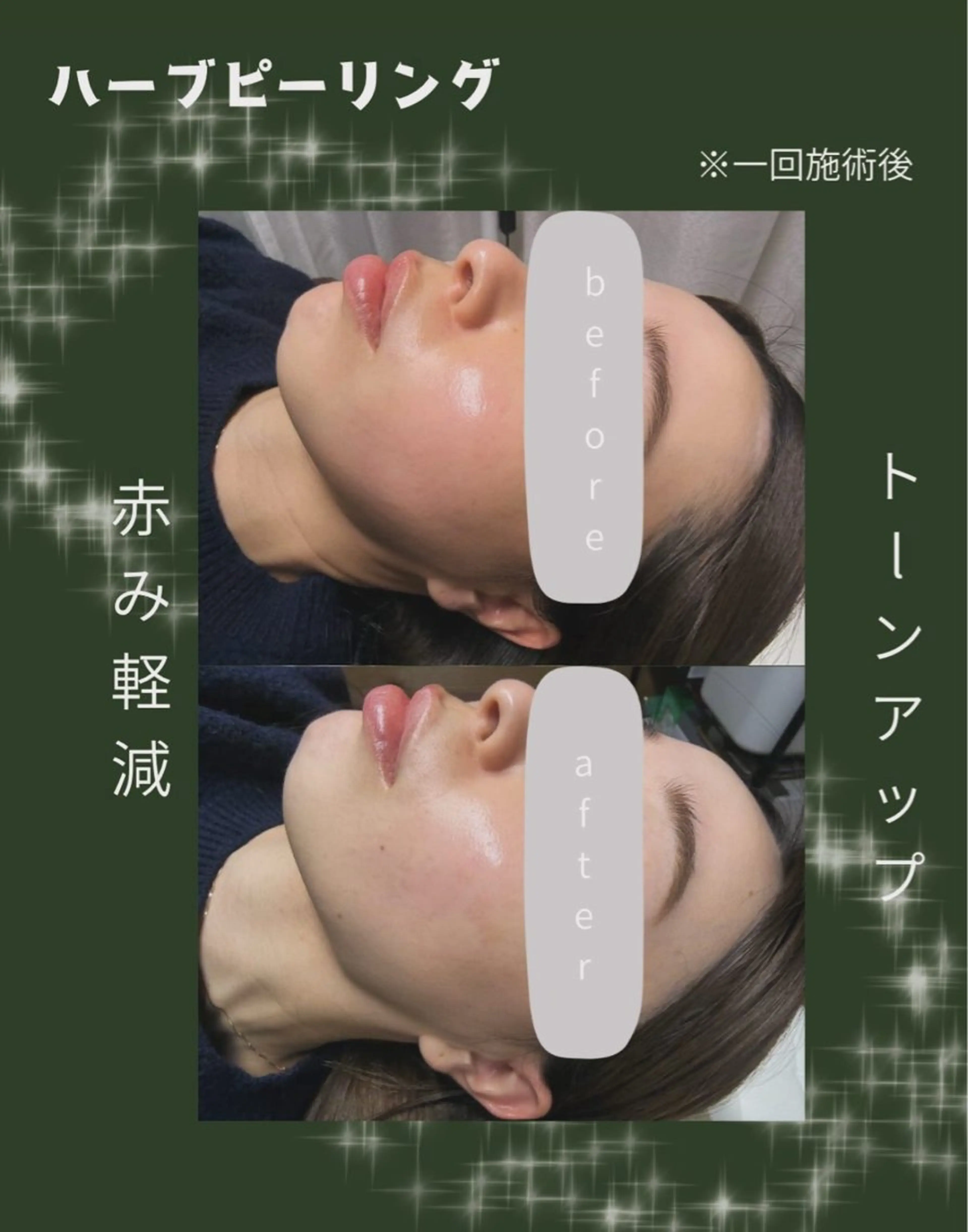 エステ リラク 美容サロン réposのその他イメージ