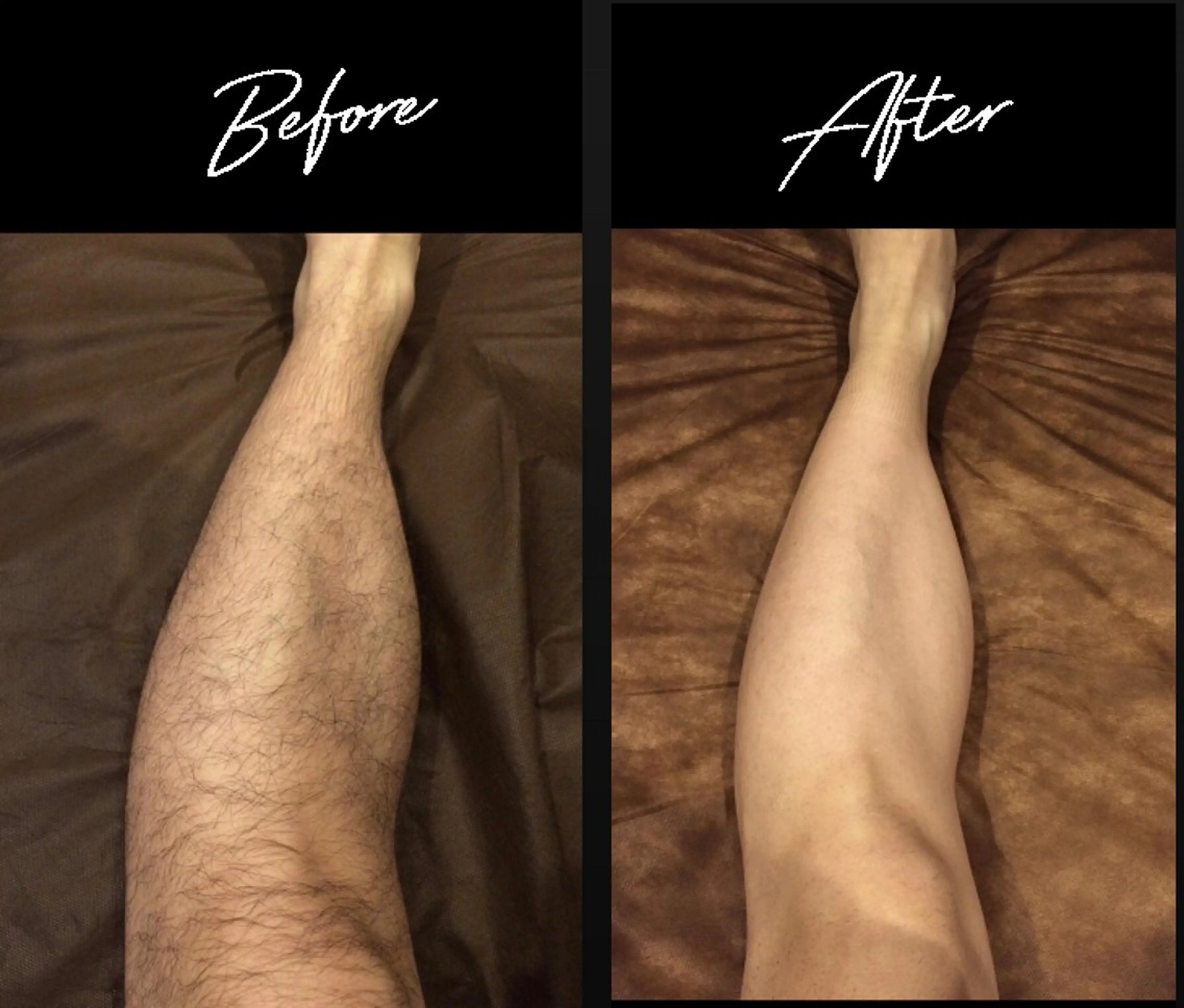 無人セルフ脱毛サロン MIRAE(ミレ)のエステ・リラクイメージ