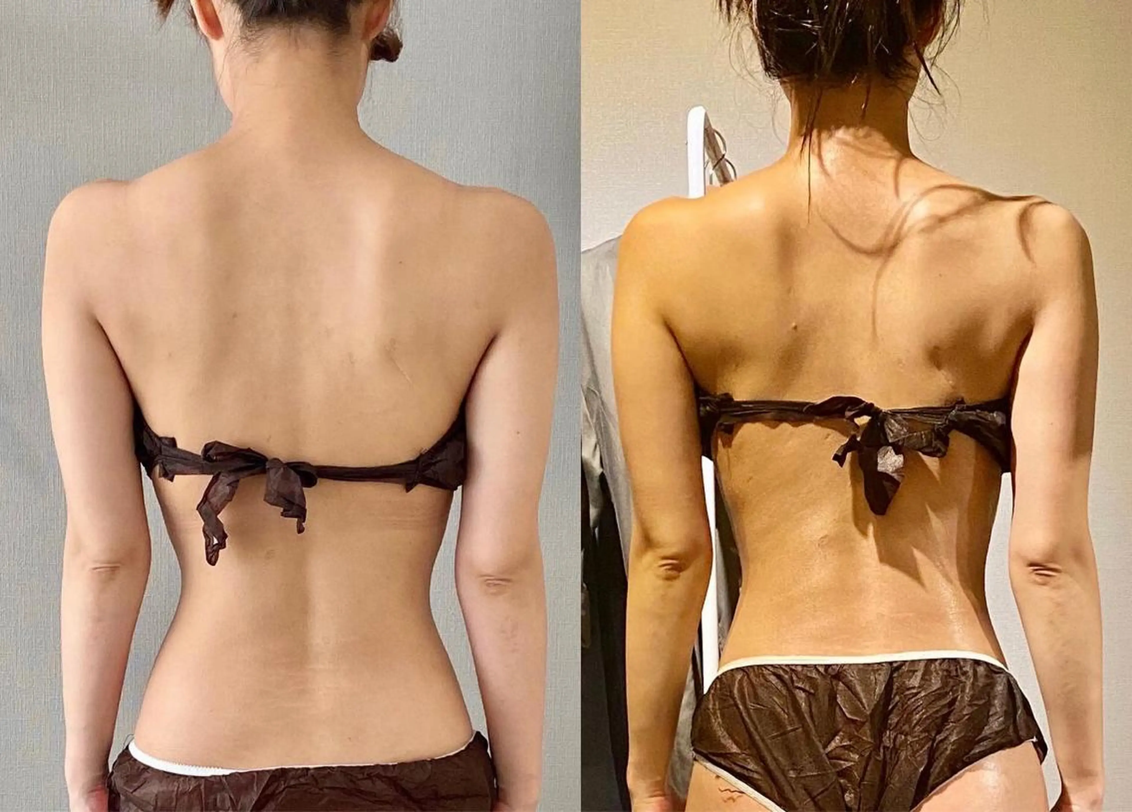 エステ BONHEUR 脱毛のその他イメージ