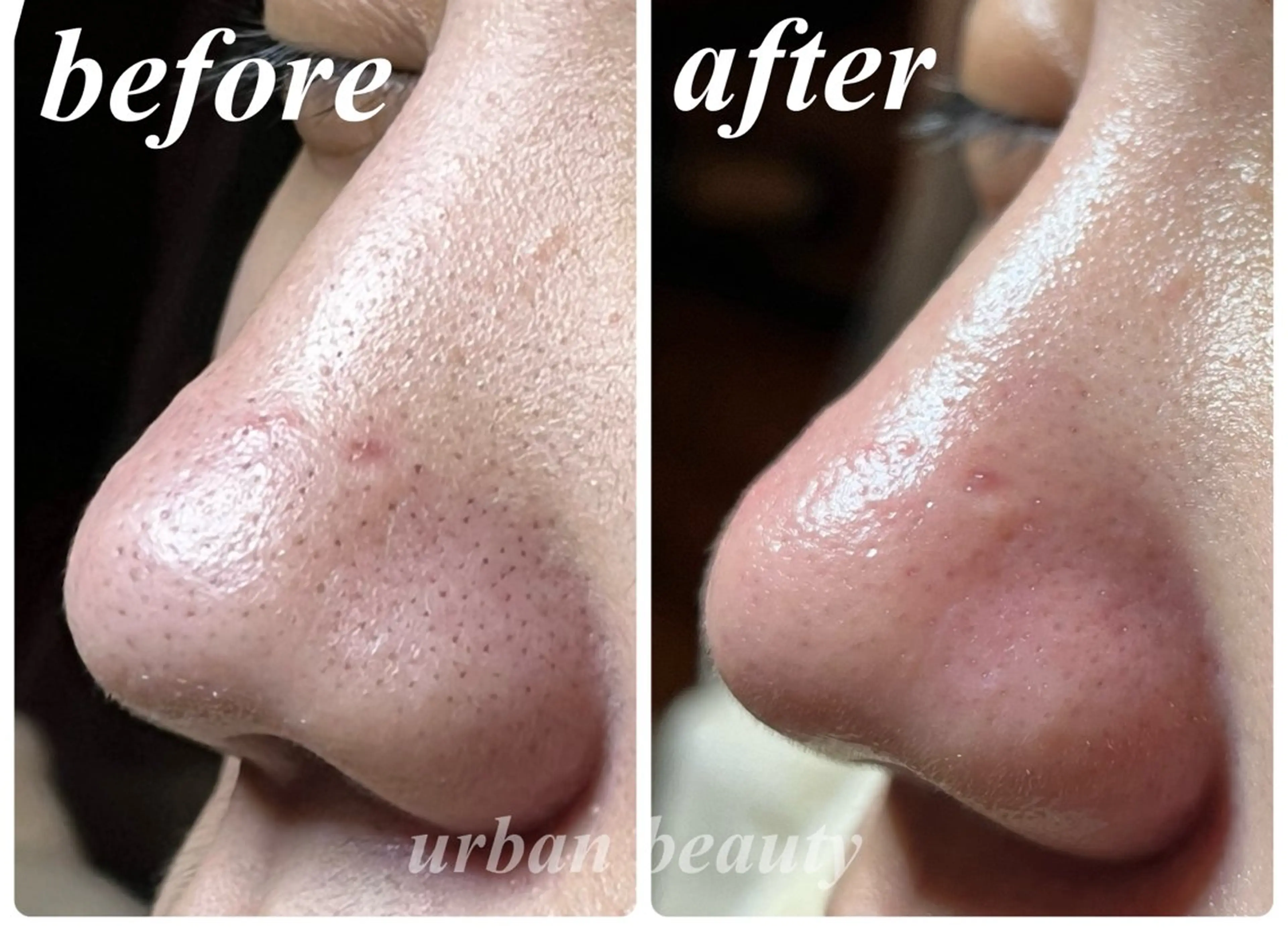 エステ リラク 結果重視｜毛穴エステ ｜友綱理恵のエステ・リラクイメージ