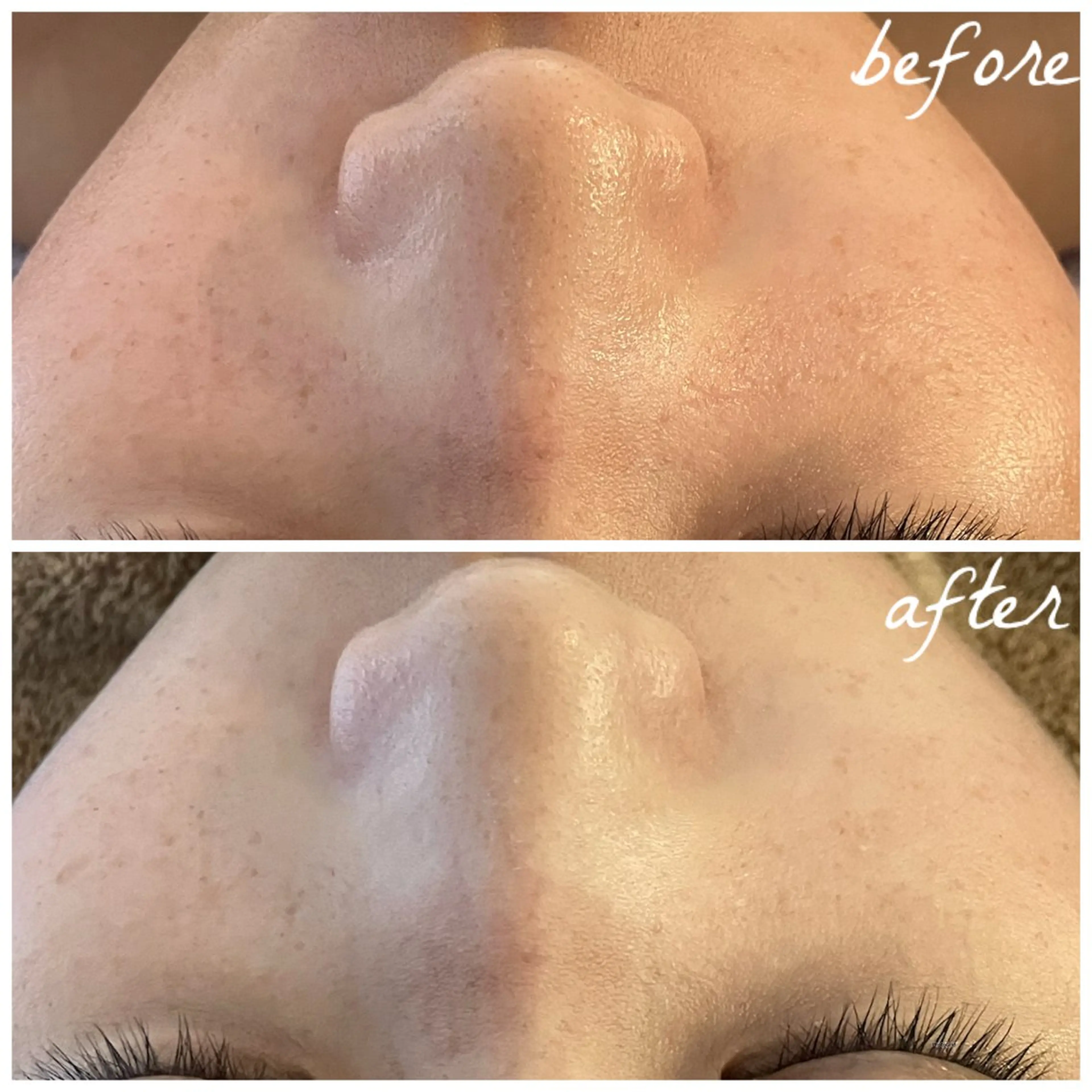 メンズ エステ メナード岐阜茜部 杉浦のエステ・リラクイメージ