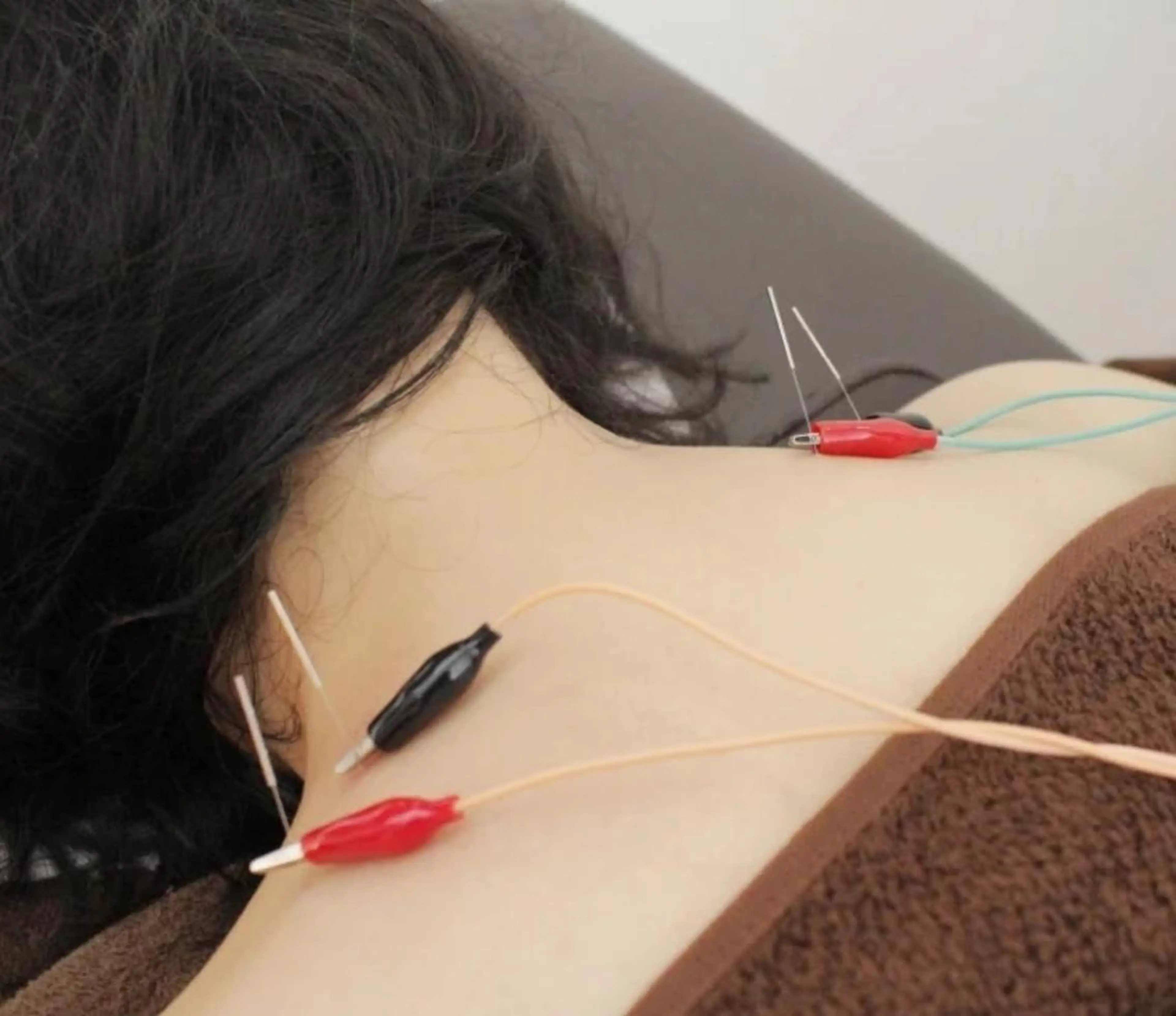 MYCARE 鍼灸&マッサージ代表のエステ・リラクイメージ