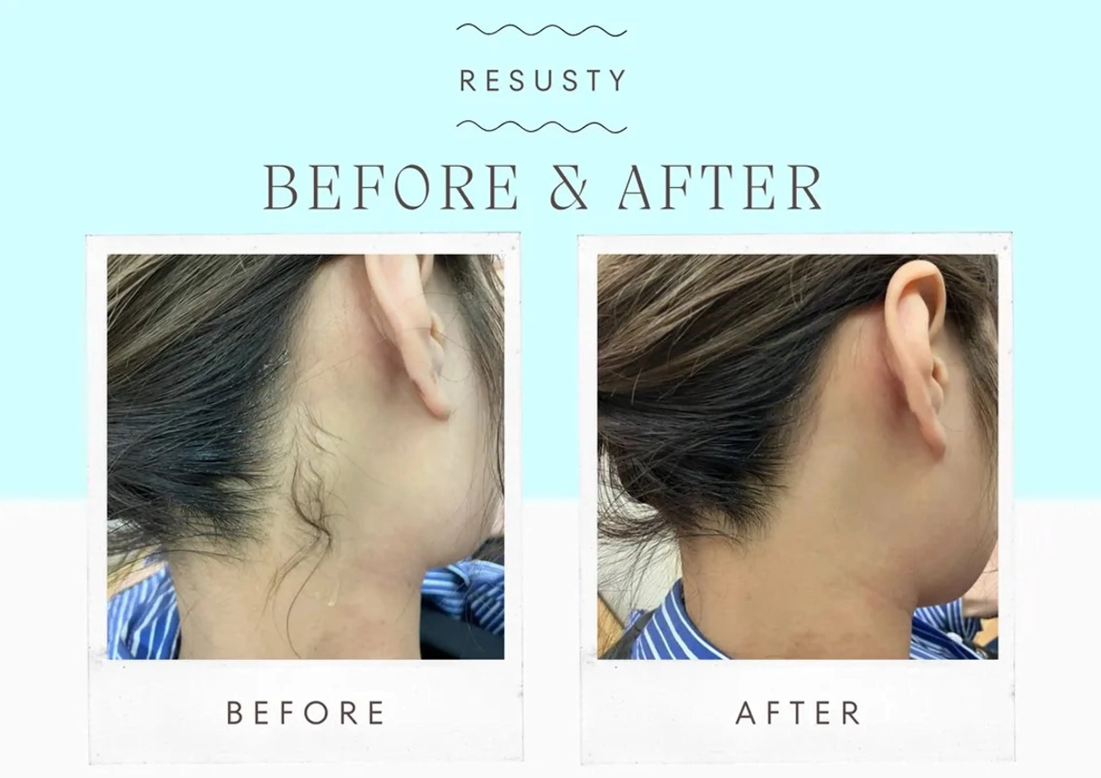 脱毛 MODE K's 白石彩夏のエステ・リラクイメージ