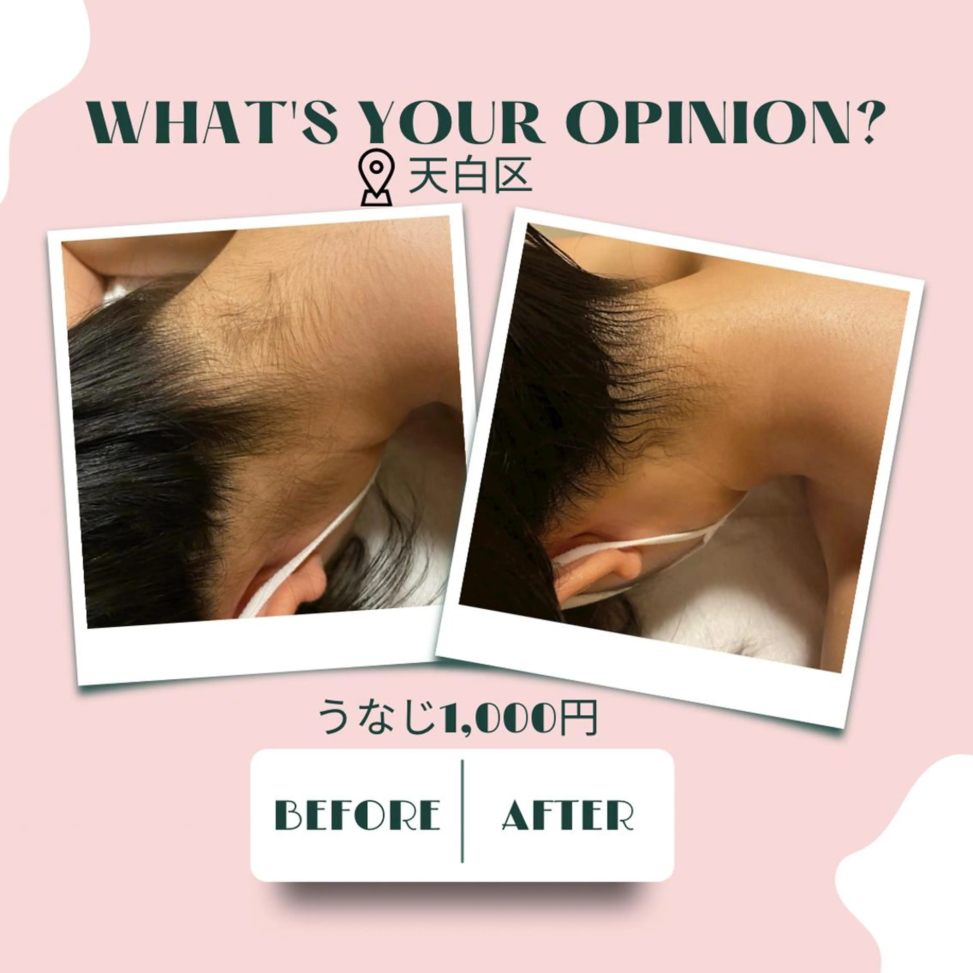 キッズ 脱毛 🌈松 本🌈のエステ・リラクイメージ