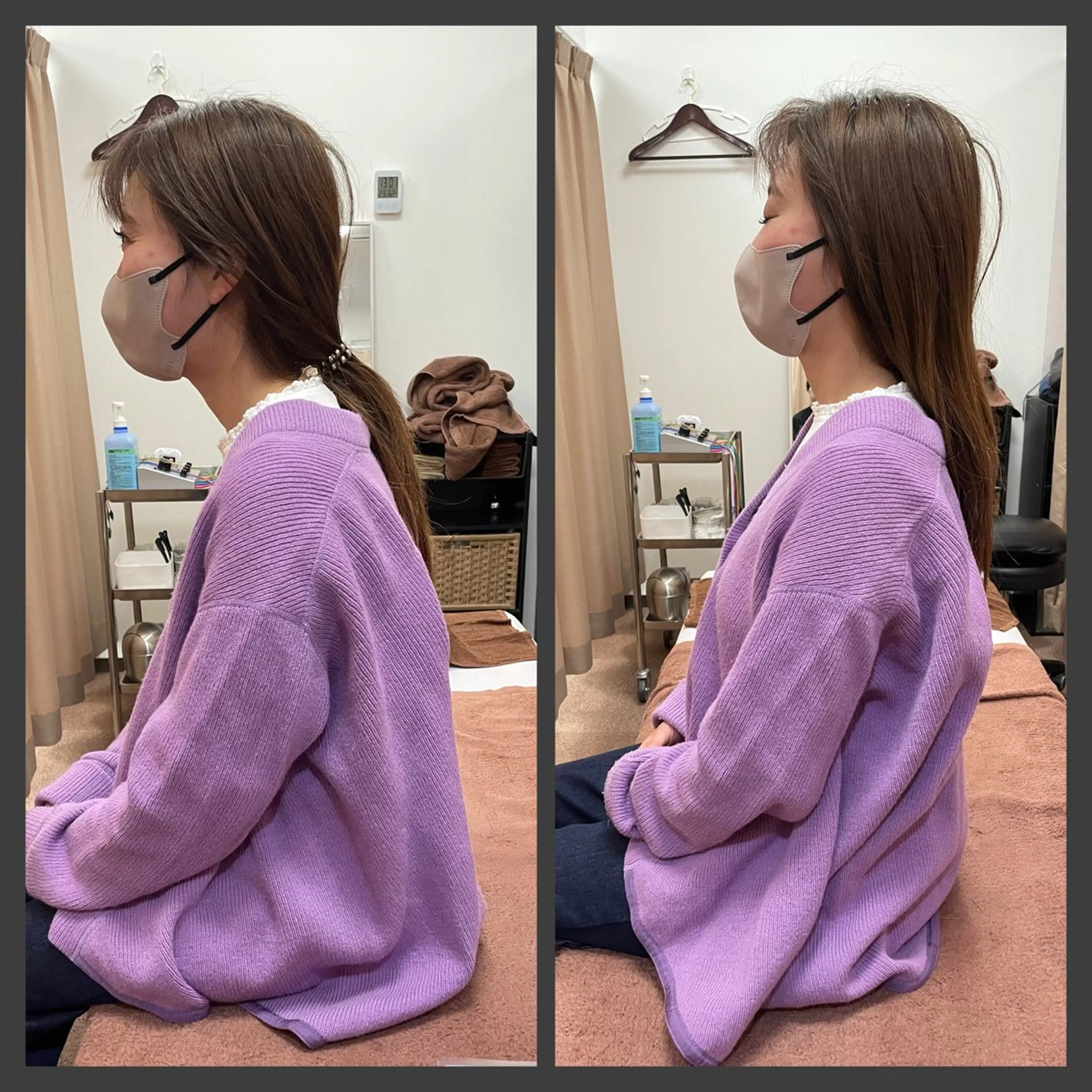 【初回価格限定】美容整体　猫背・巻肩の写真