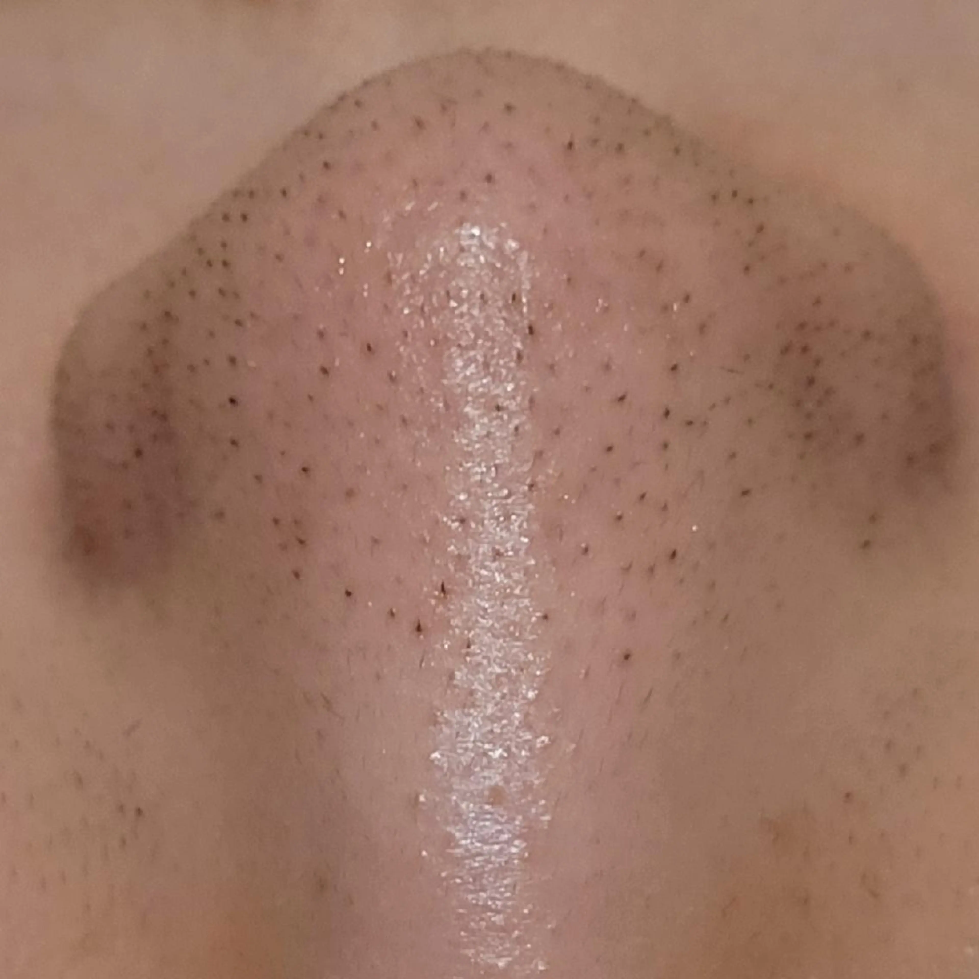 毛穴/肌管理/痩身/ ボディケア/satoのエステ・リラクイメージ