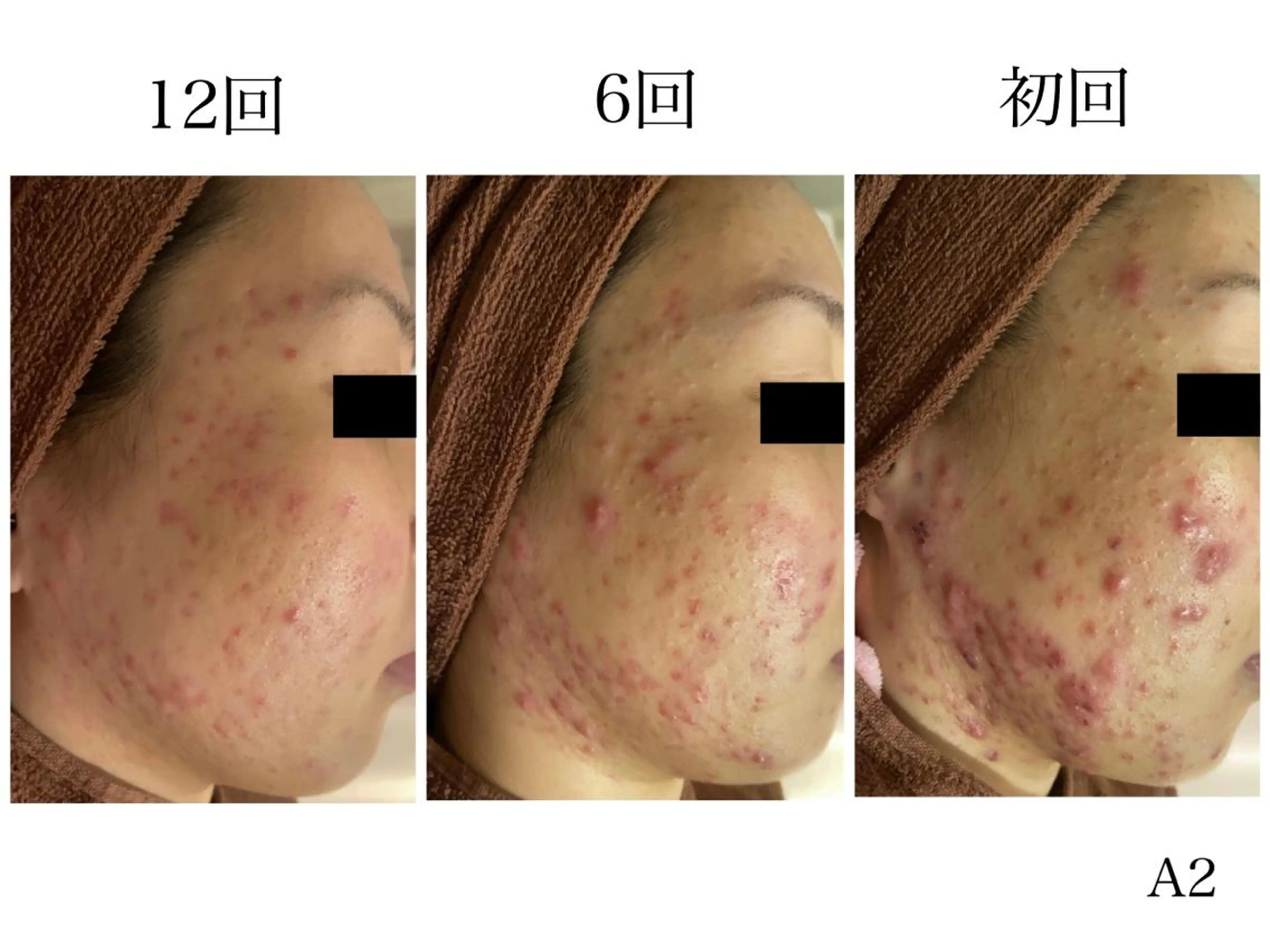 ミディアム マツエク・マツパ アイブロウ エステ リラク ニキビ・肌質改善専門 ♡人生が変わるサロンのエステ・リラクイメージ