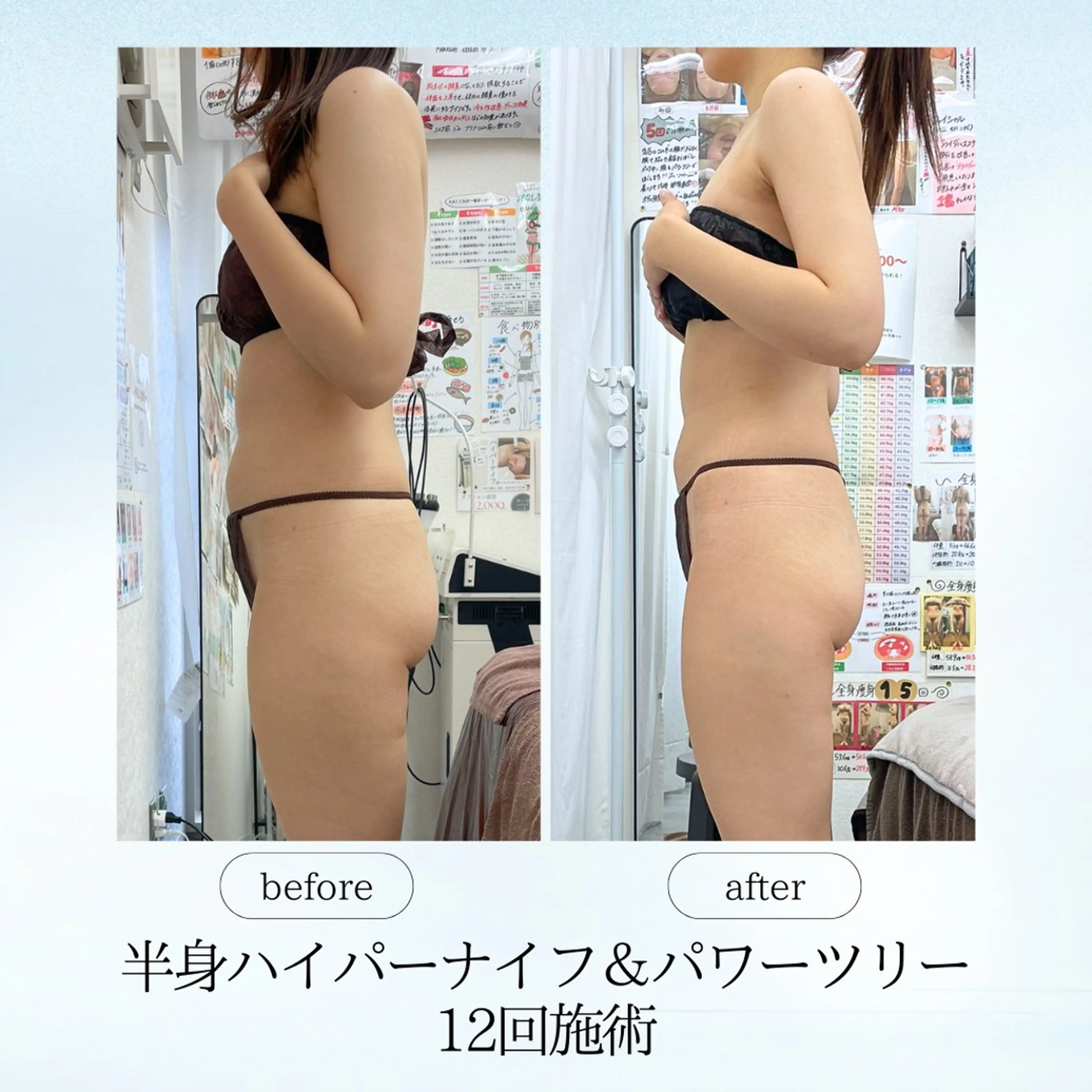エステ リラク 《痩身、小顔専門店》 エスプレッソのエステ・リラクイメージ