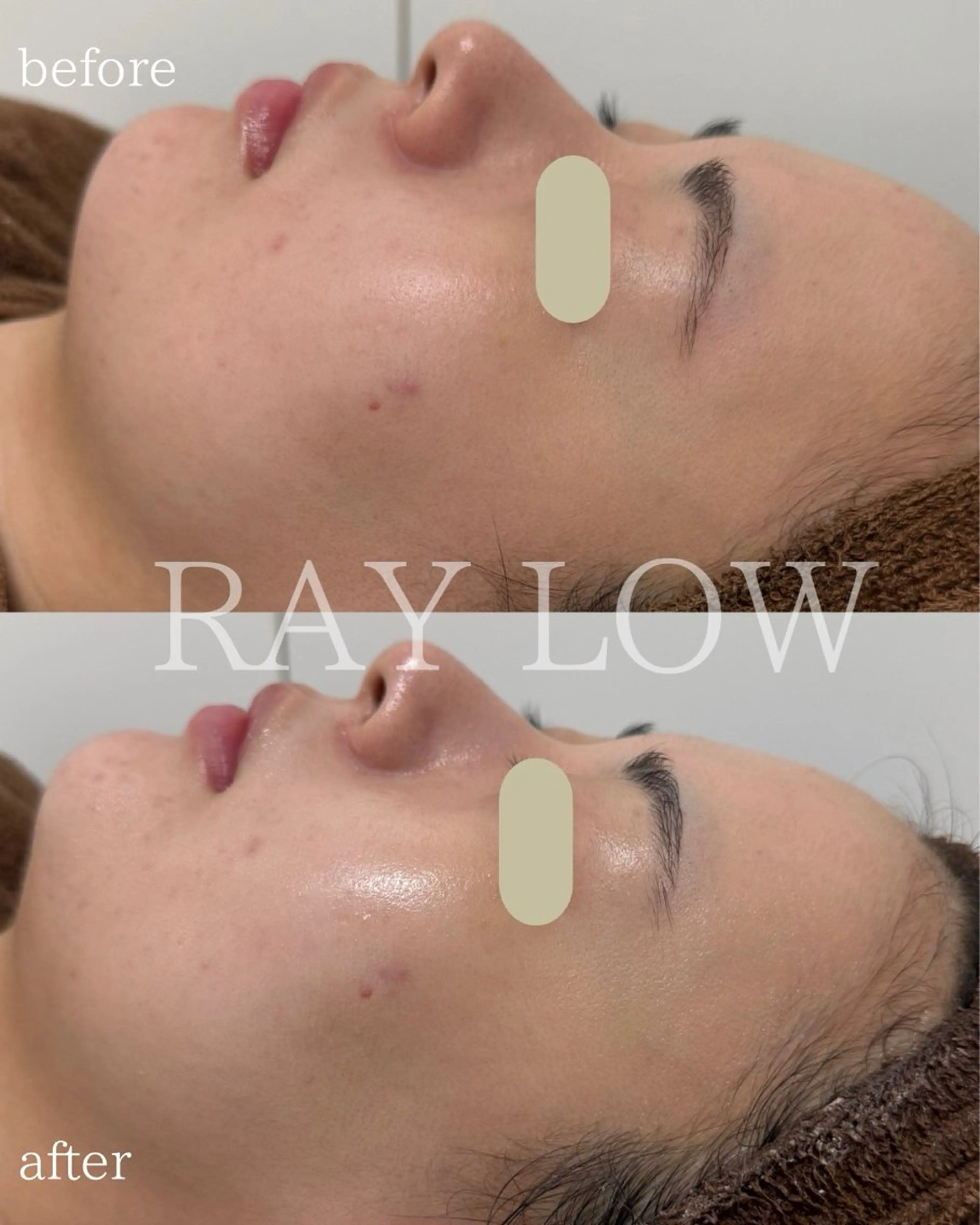 RAY LOW所属・RAY LOW レイロウのエステ・リラクイメージ