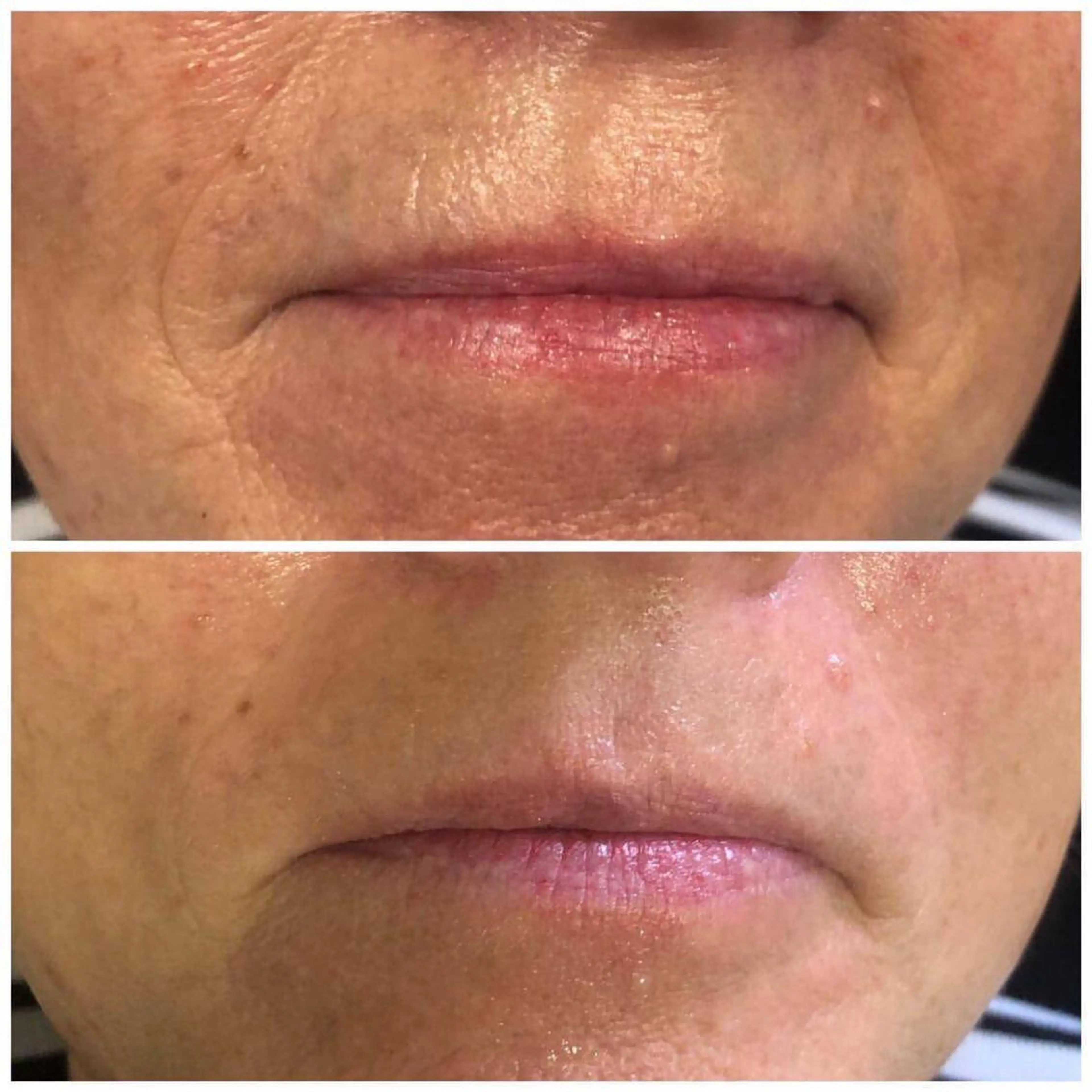 【リベルハーブピーリング認定店】敏感肌・美白脱毛専門店Dione立川店所属・Dione 立川店のエステ・リラクイメージ