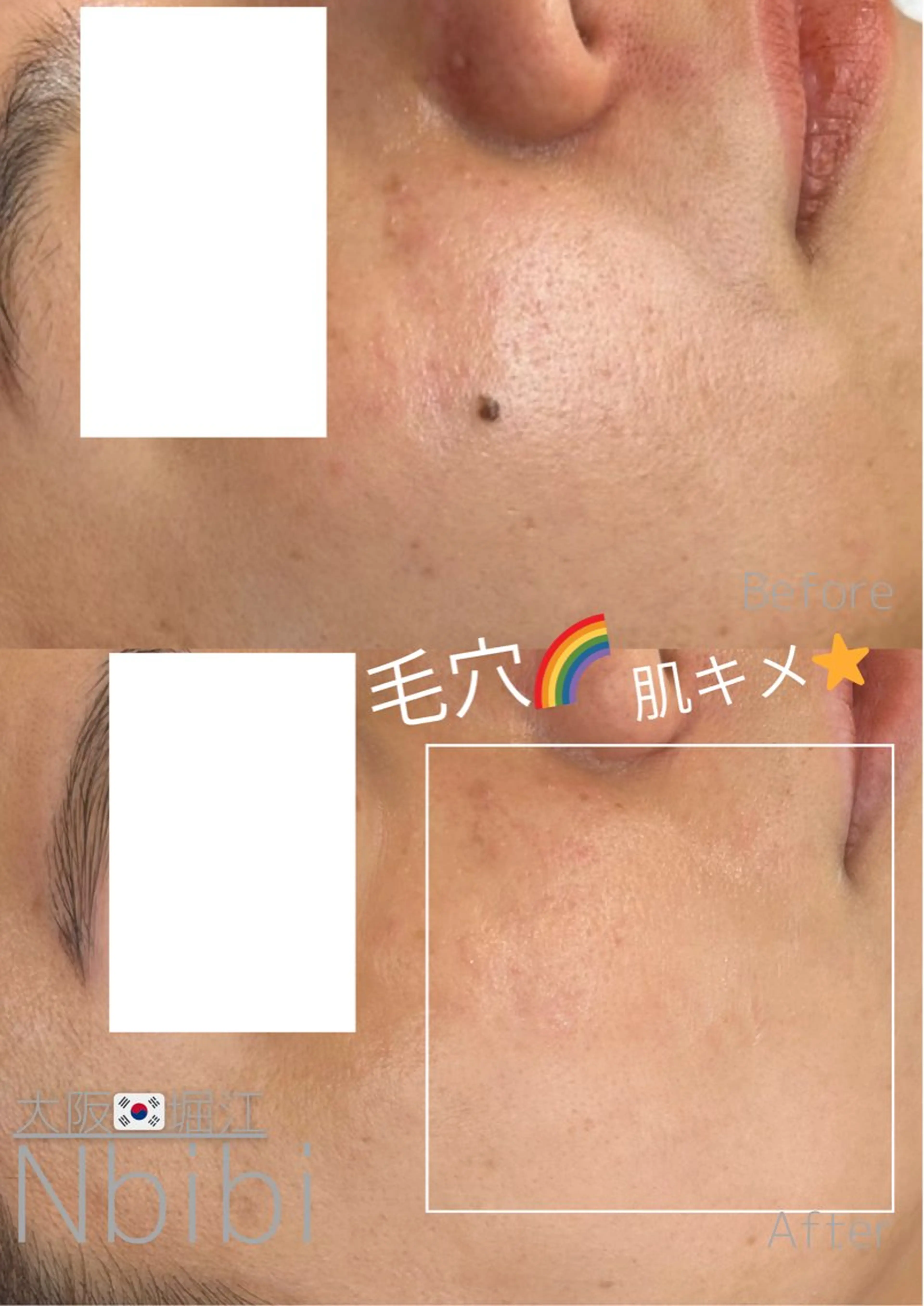 エステ 韓国🇰🇷価格 サロン_Nbibiの眉毛・アイブロウイメージ