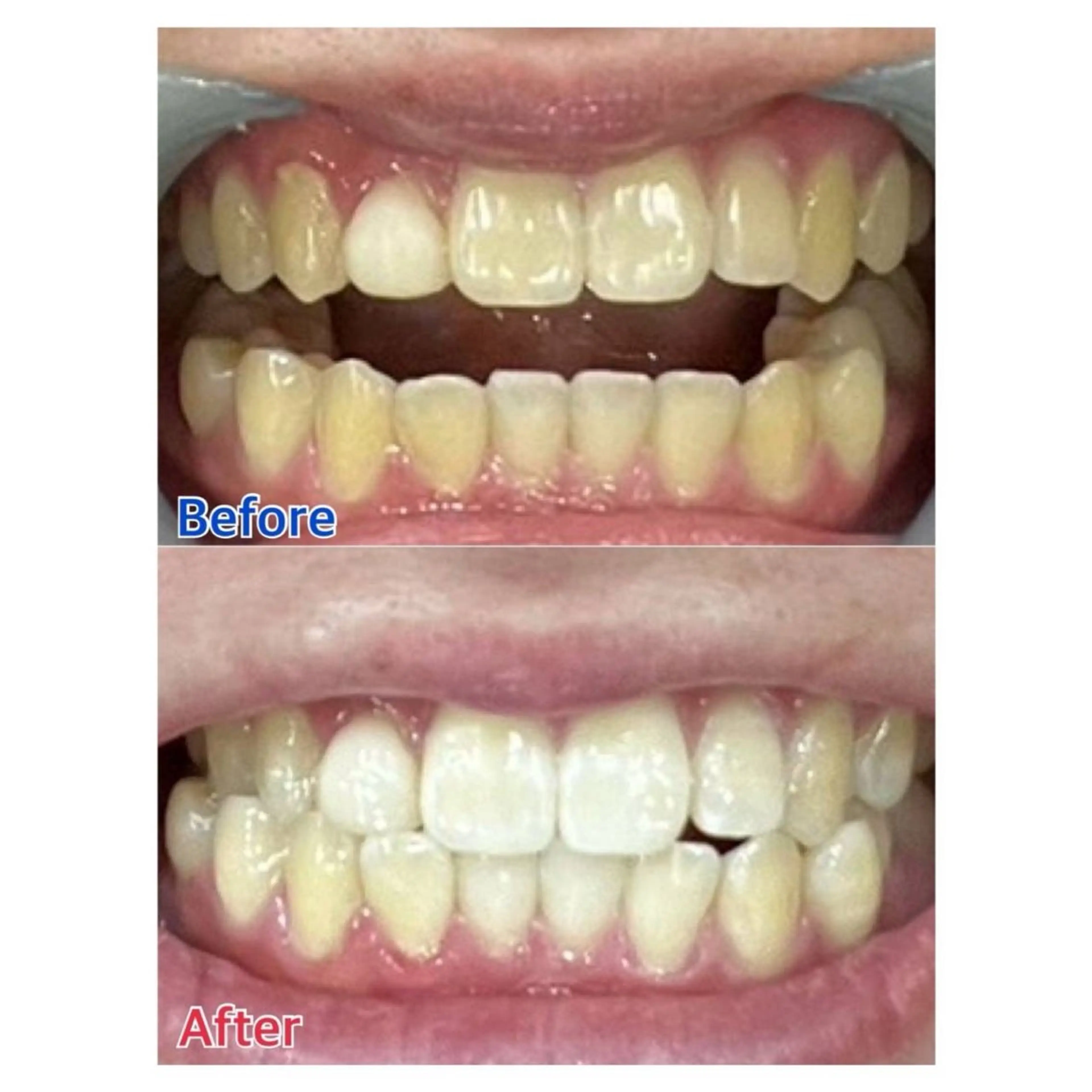 Melty 輝のその他イメージ