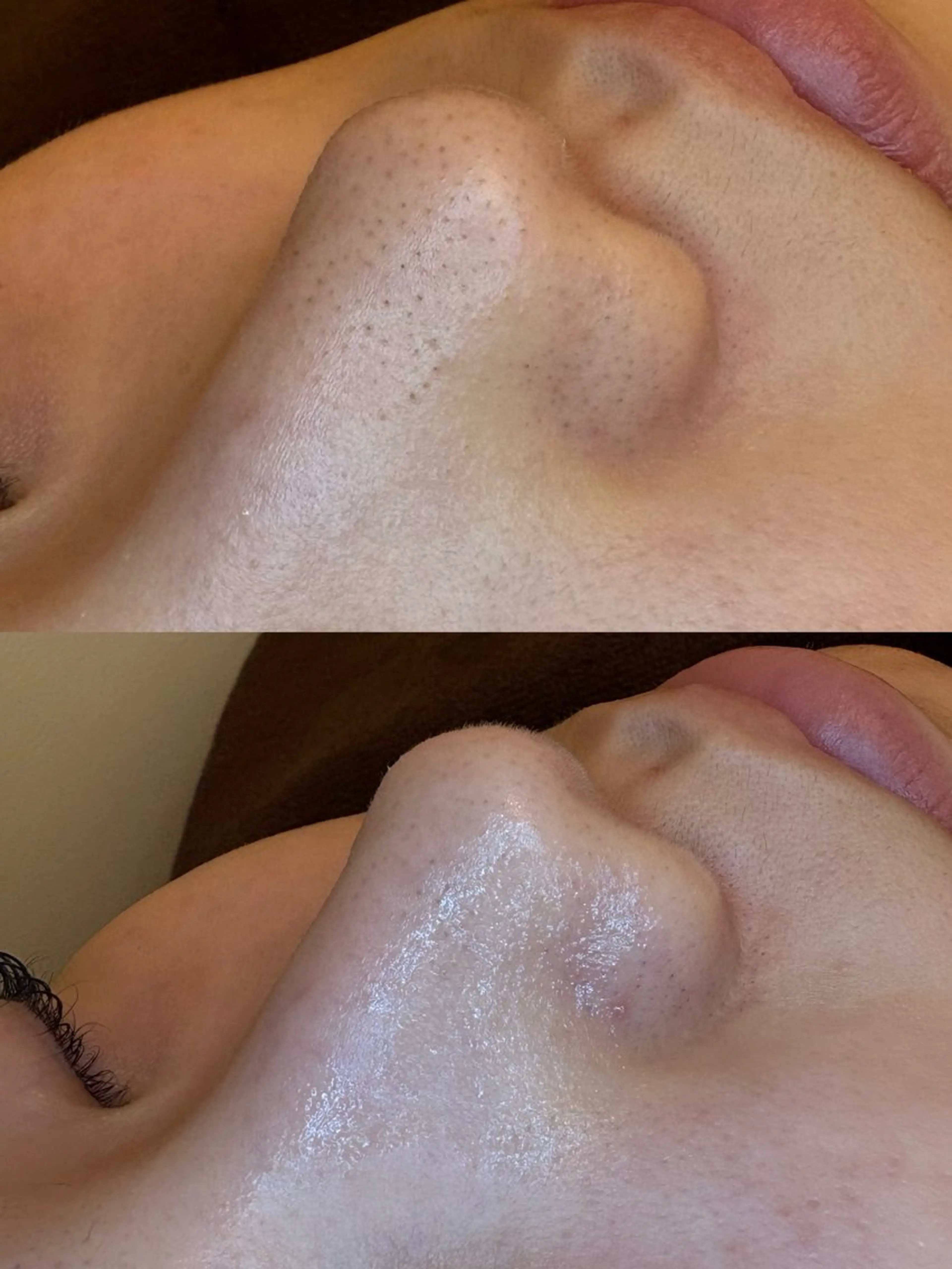 🤍アベシュリ /フェイシャル🤍のエステ・リラクイメージ