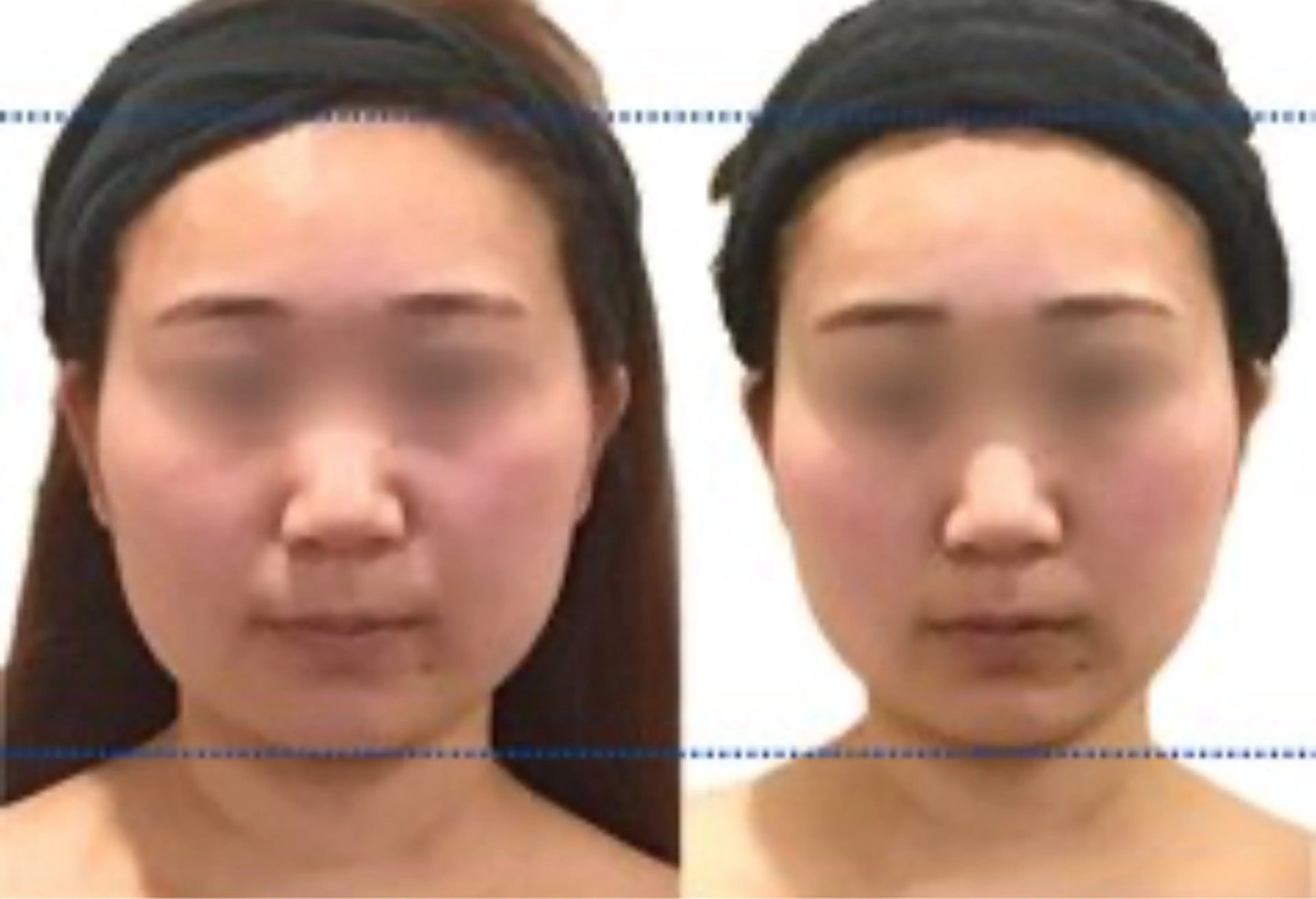 韓国肌管理HARRY ・ハリー🤍大村のエステ・リラクイメージ