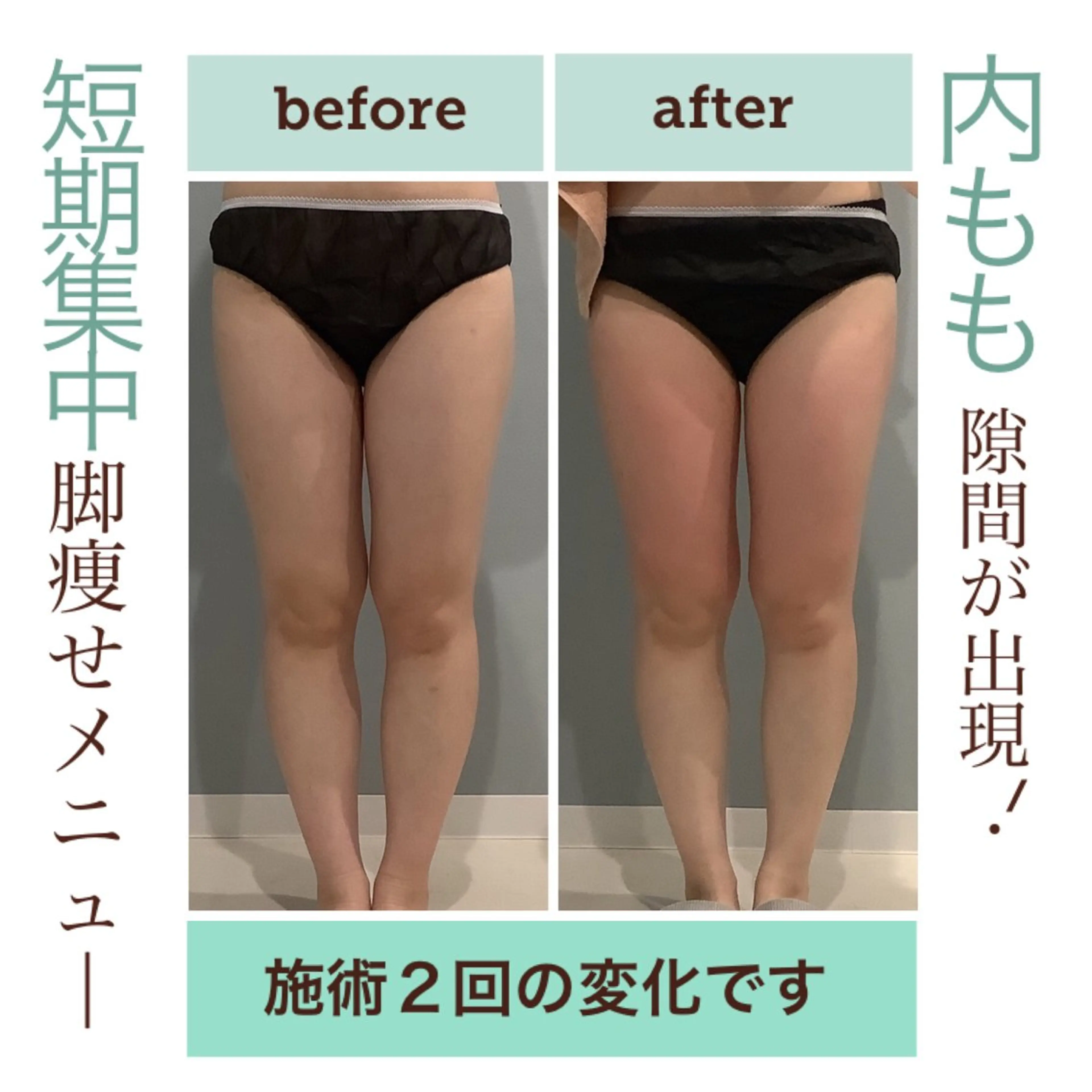 エステサロン JURISのエステ・リラクイメージ