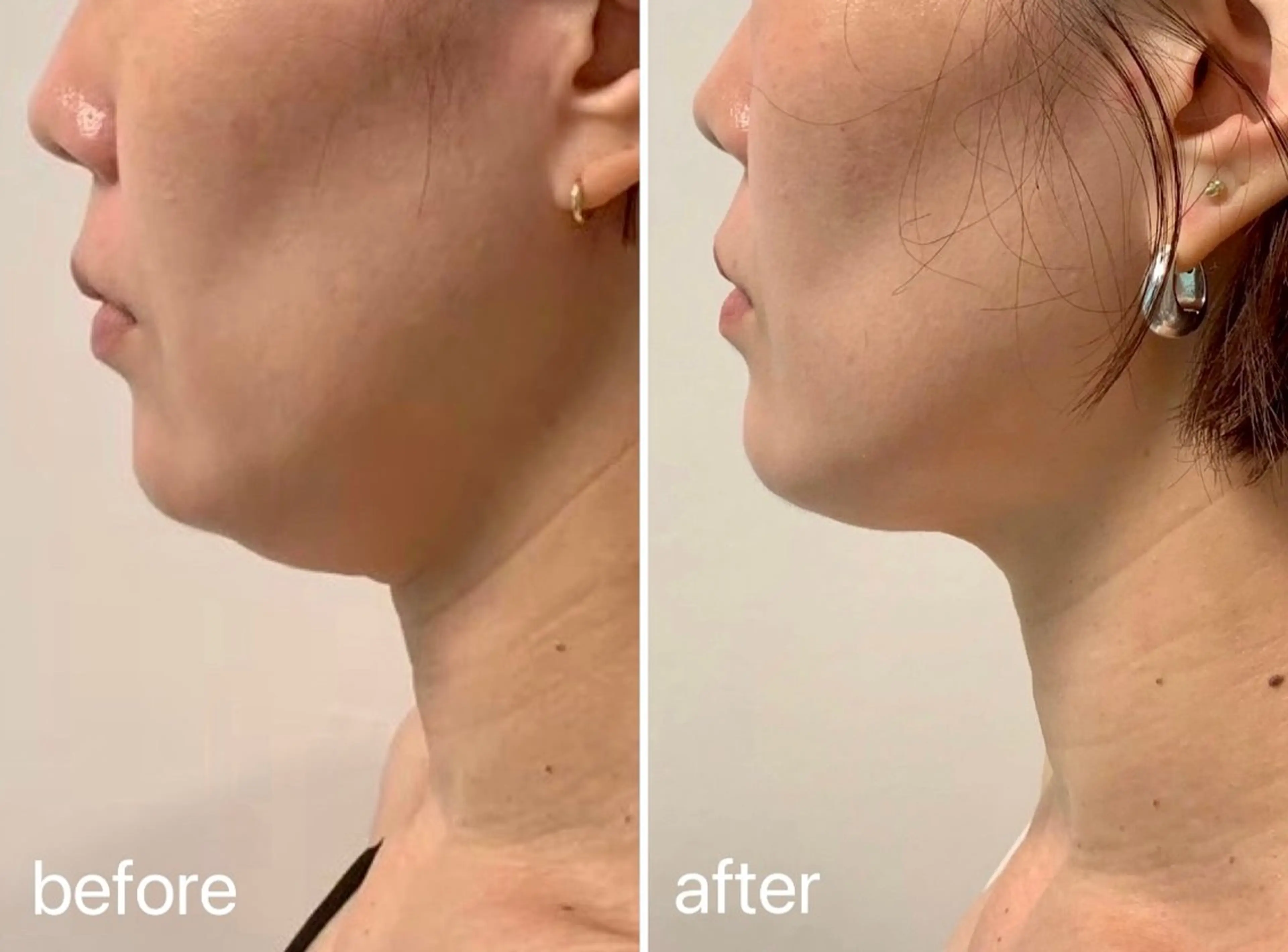 エステ スキンケアサロン　デディア所属・米谷🎀 デディア恵比寿🪞✨のエステ・リラクイメージ