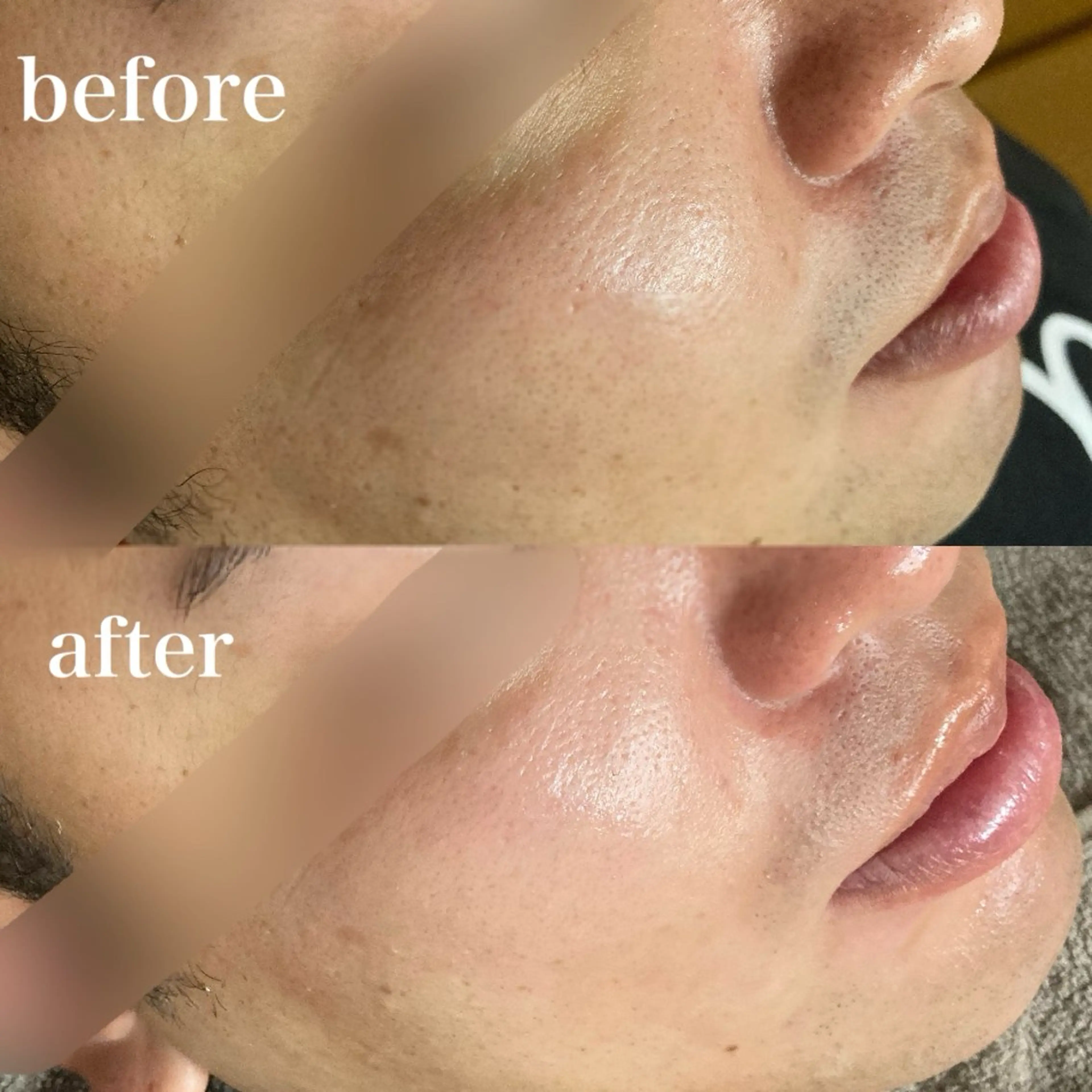 磐田｜LAYLA 一番丁寧な脱毛店のエステ・リラクイメージ