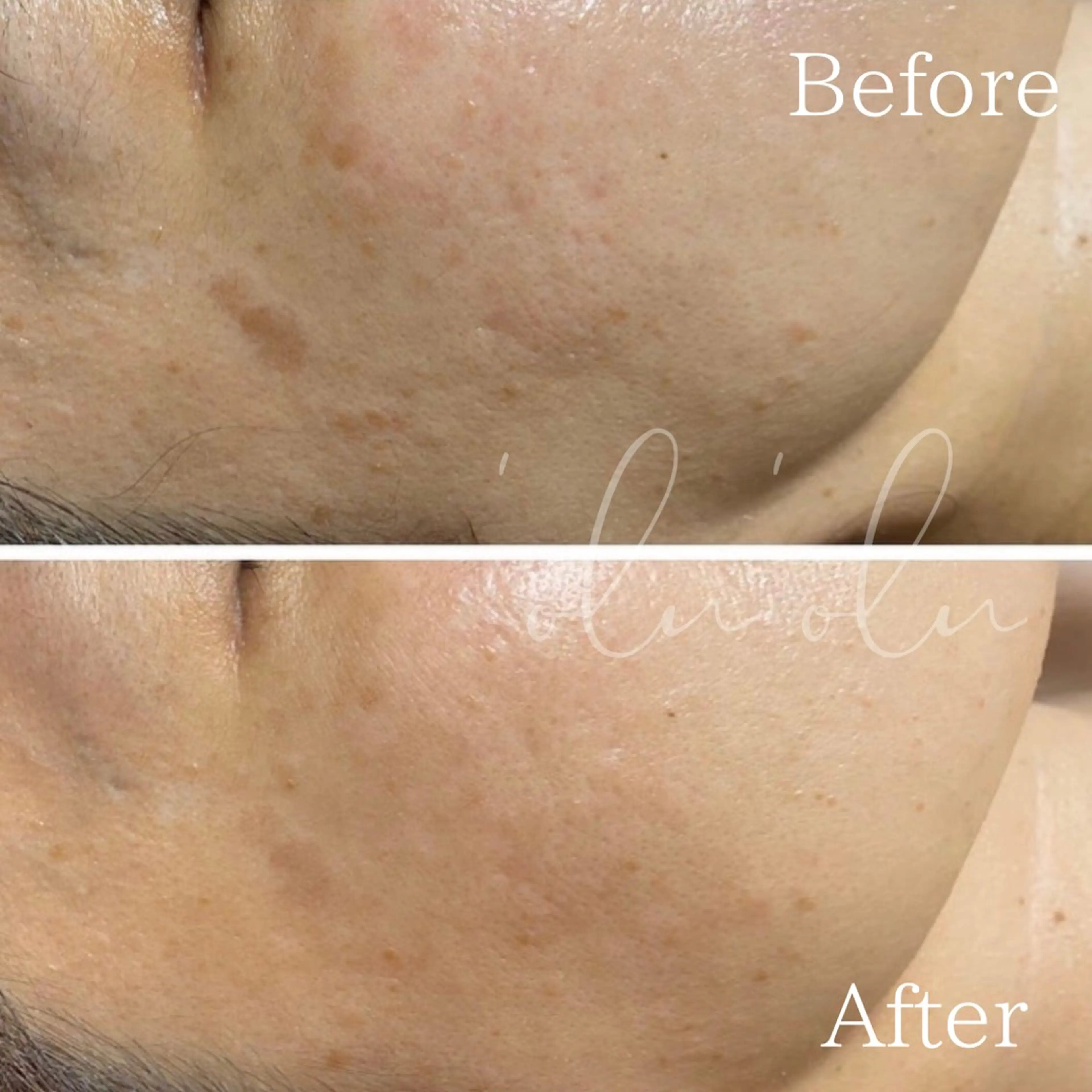 'Olu'Olu シミ・毛穴専門サロンのエステ・リラクイメージ