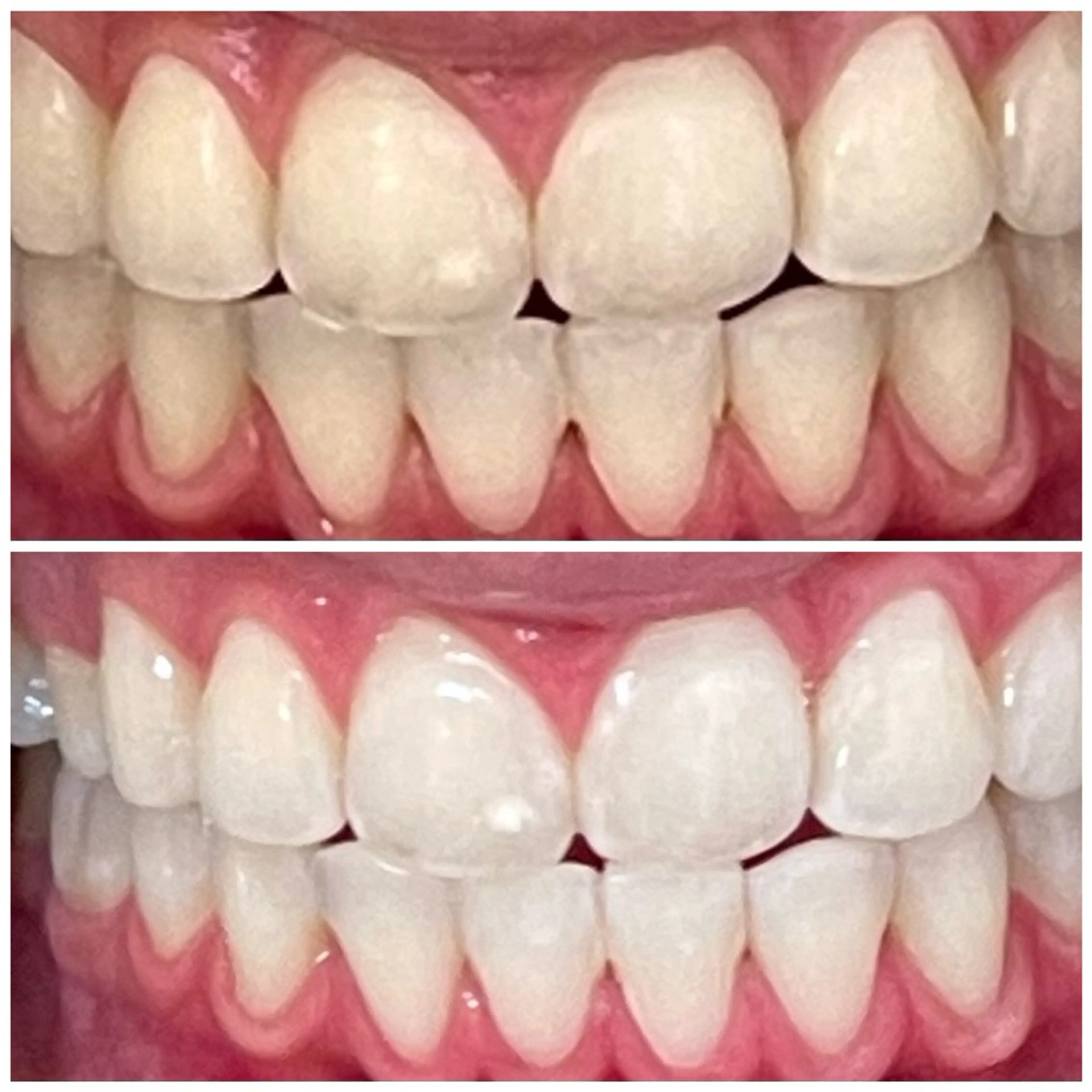 メンズ DIAMOND BEAUYのその他イメージ