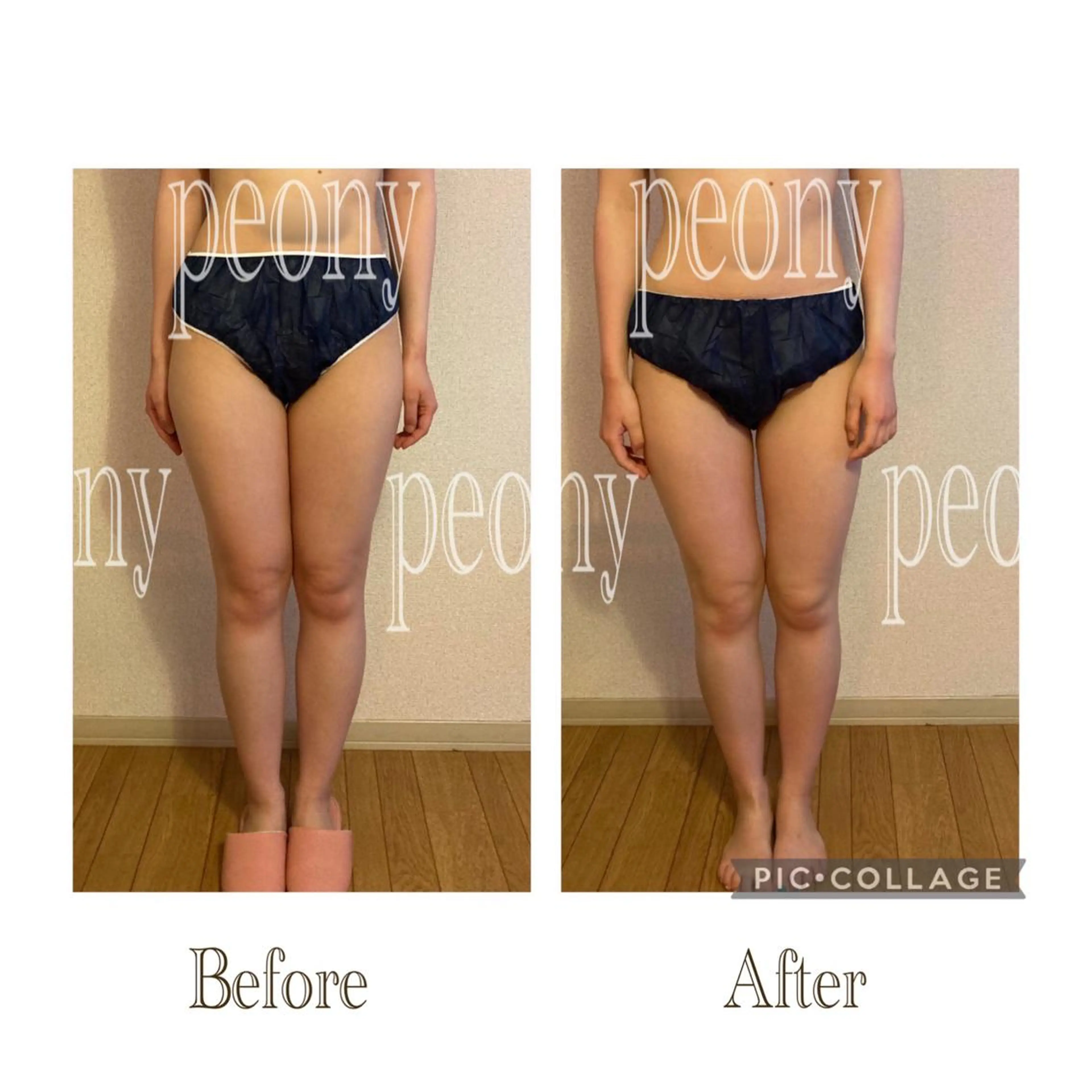 エステ デトックス美容専門 サロンｐｅｏｎｙのエステ・リラクイメージ