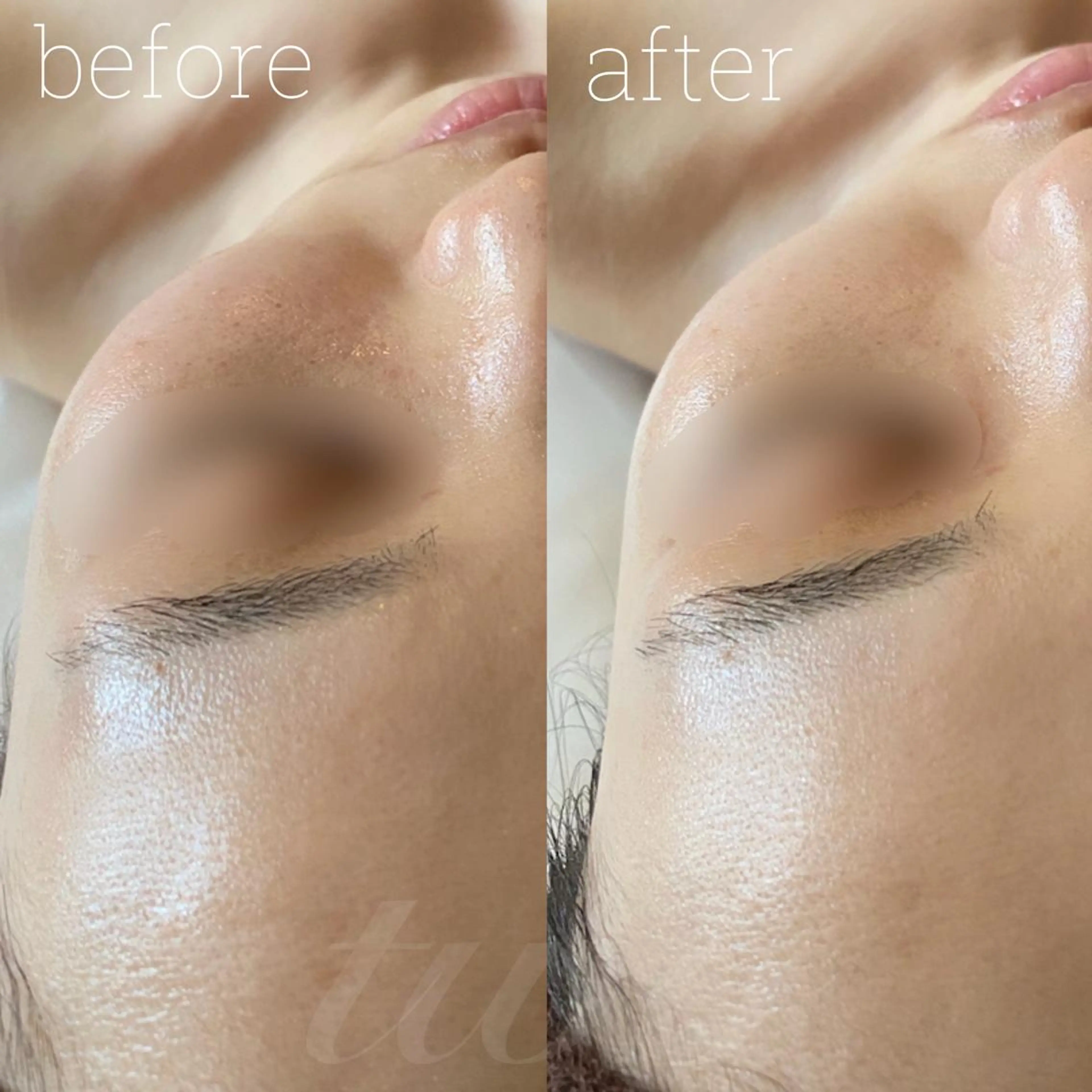 《心斎橋》 twoのエステ・リラクイメージ