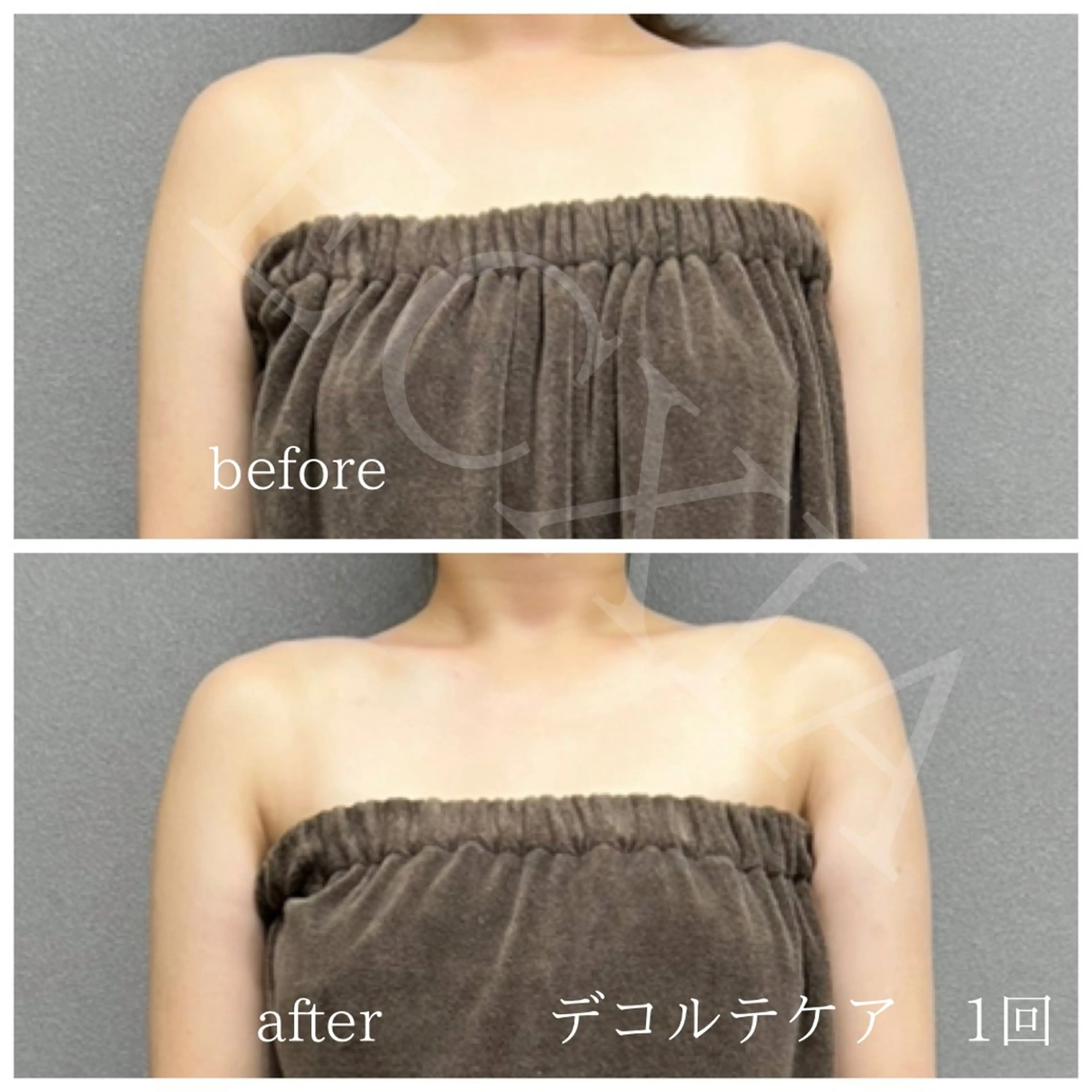 その他 ECXIA 【エクシア】のエステ・リラクイメージ