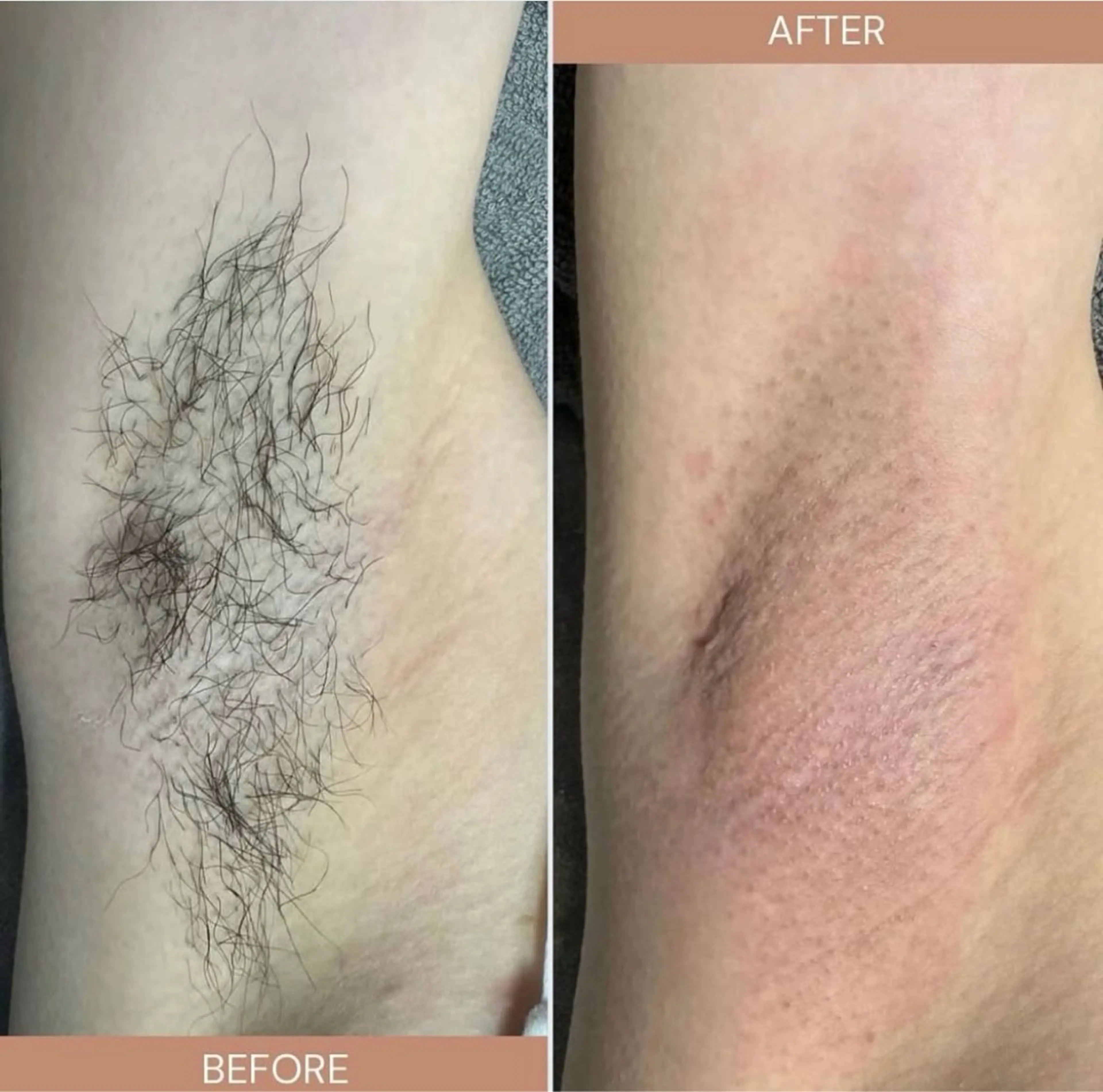 シュガーリスト Nanaのエステ・リラクイメージ