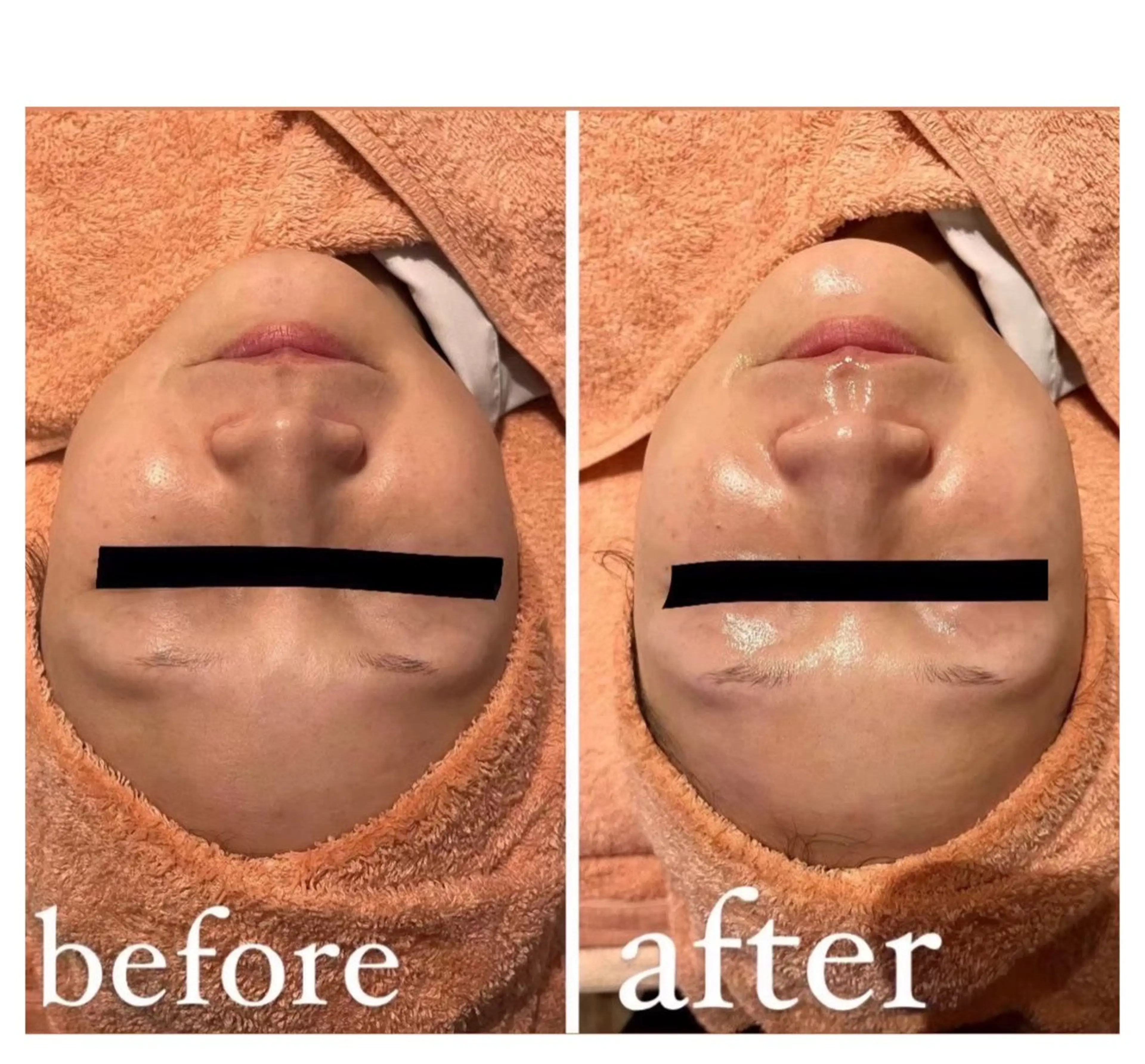 エステ エムフルール リラク&エステのエステ・リラクイメージ