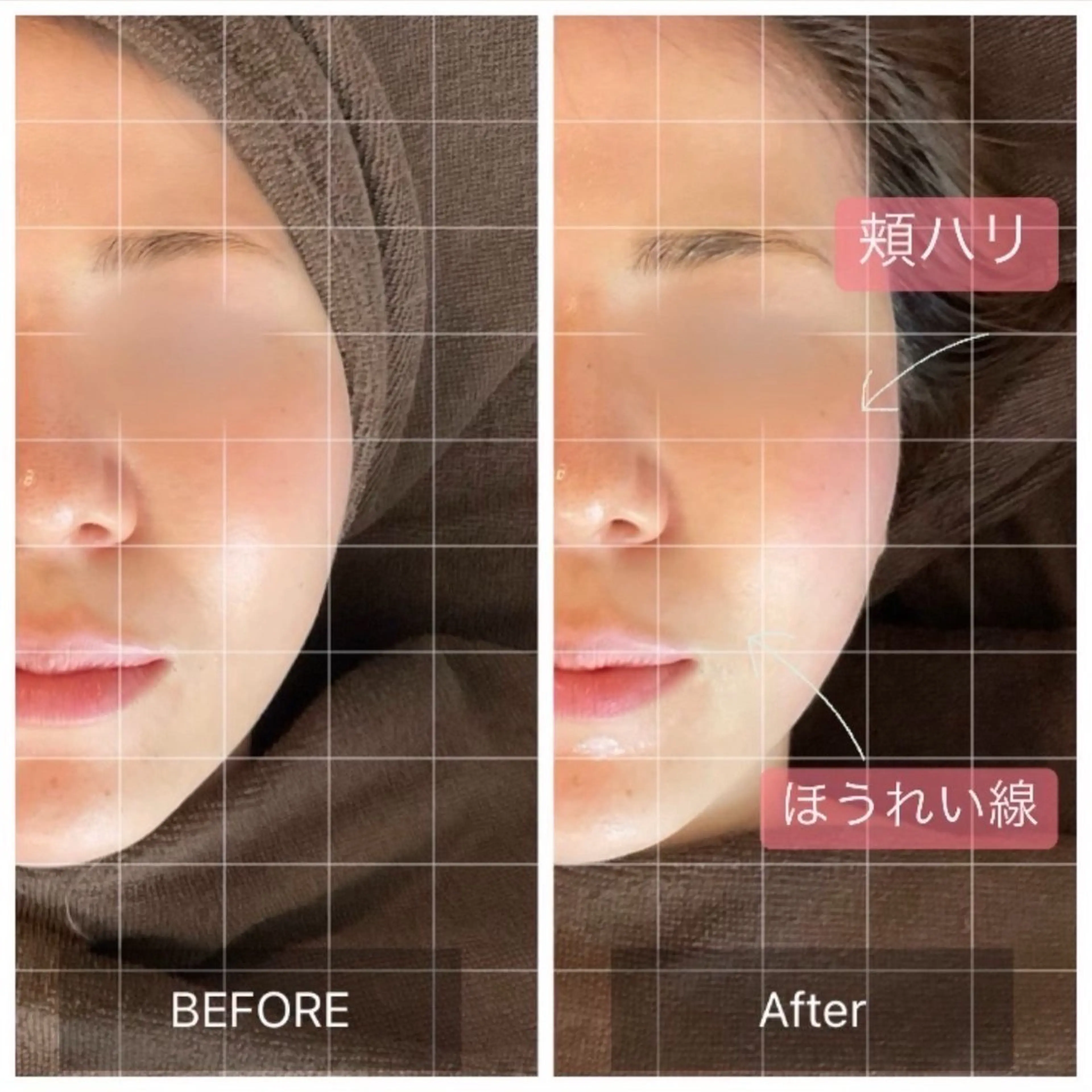 MIRAI小顔 錦糸町店のエステ・リラクイメージ