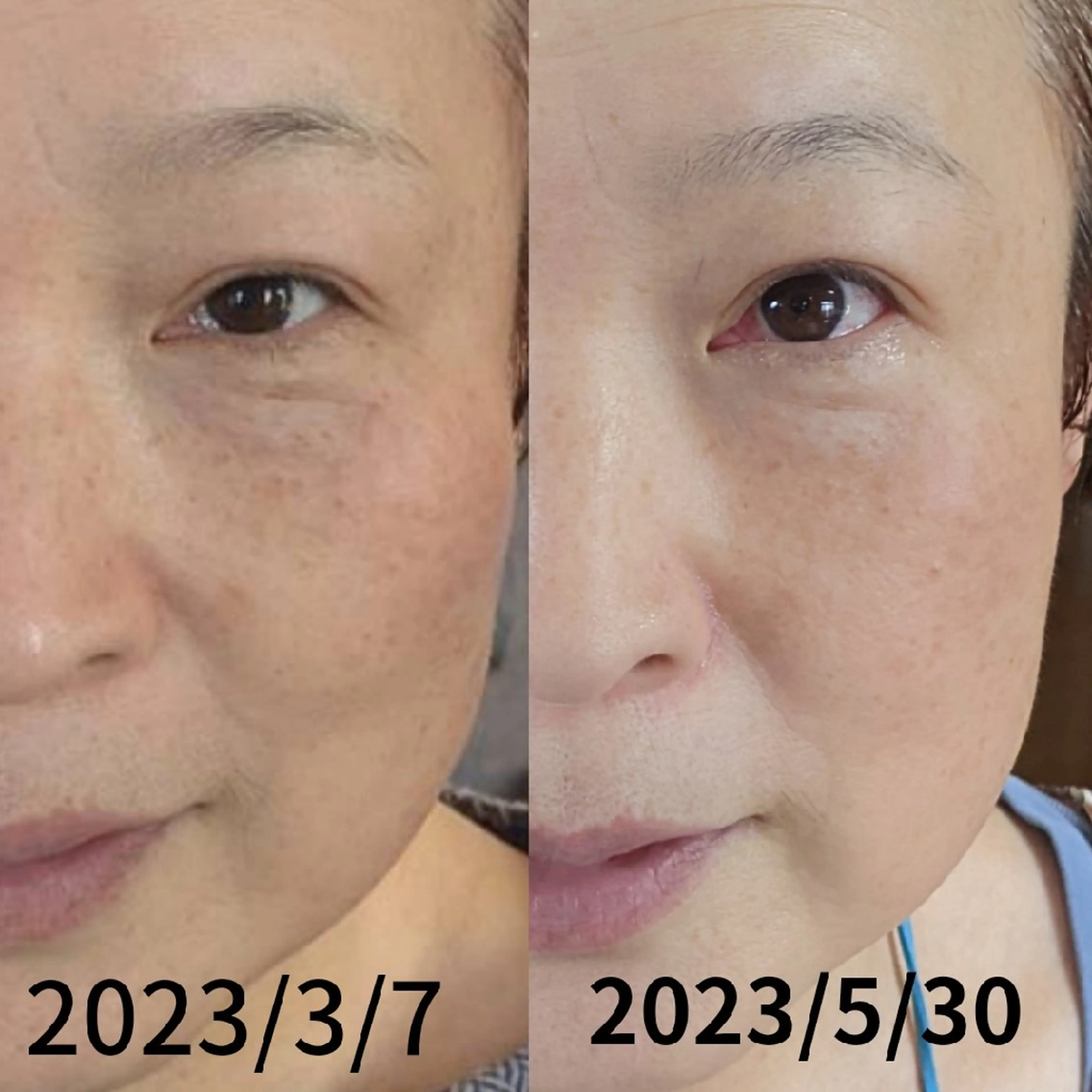 結果が出るスキンケア 肌質改善/まつパのエステ・リラクイメージ