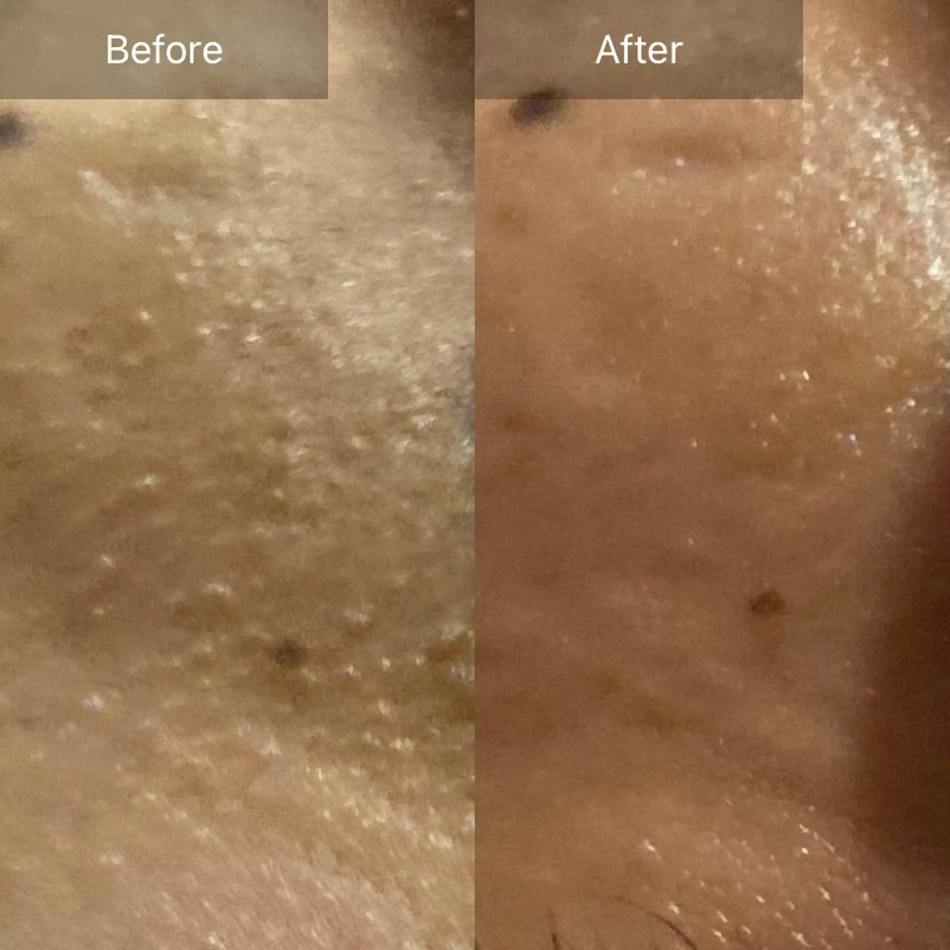 毛穴から始める肌メン テマンダリンオレンジのエステ・リラクイメージ