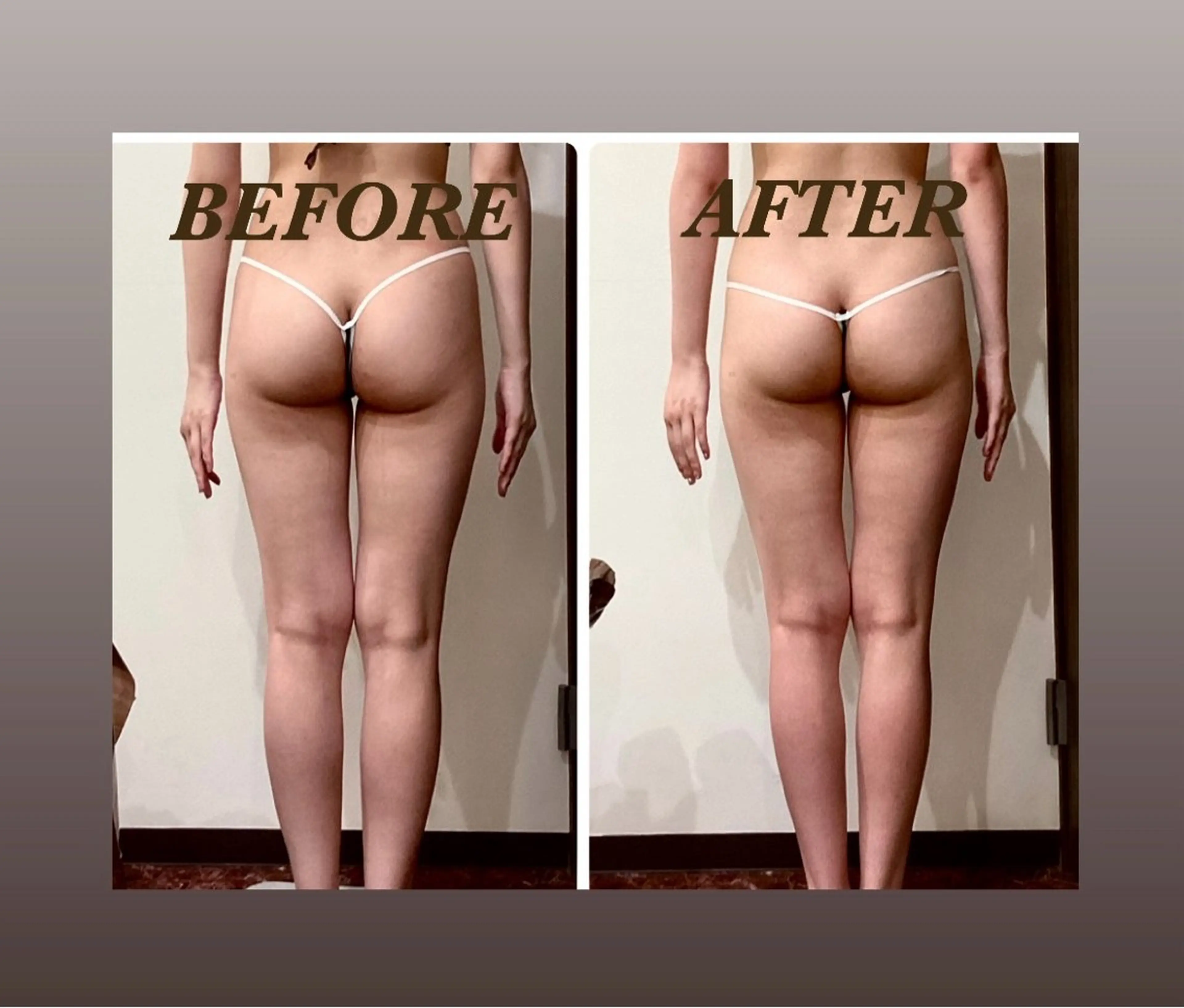 エステ リラク Prima 痩身脱毛 にごうかおりのエステ・リラクイメージ