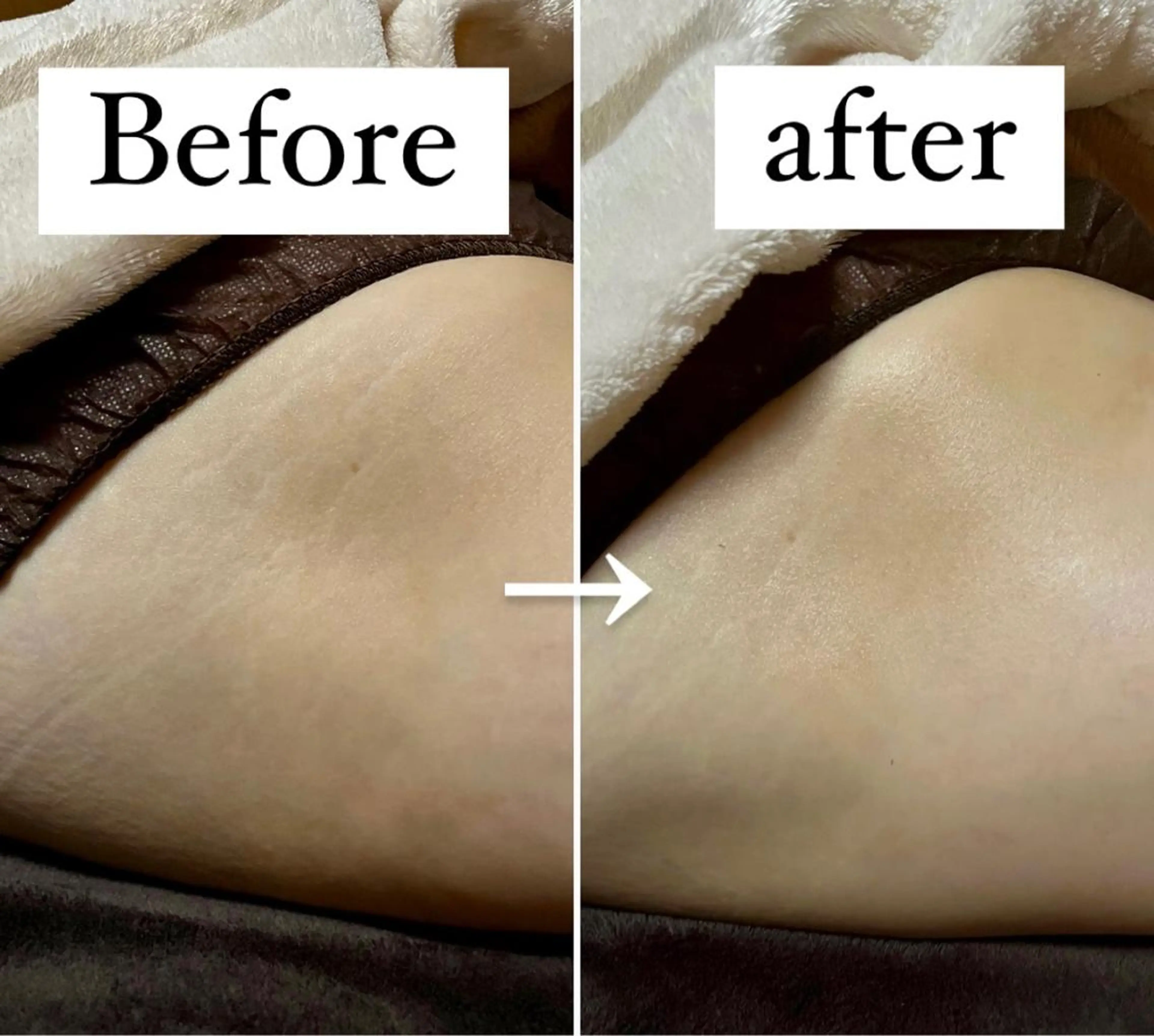 アイカワールド所属・鈴木 愛加のエステ・リラクイメージ