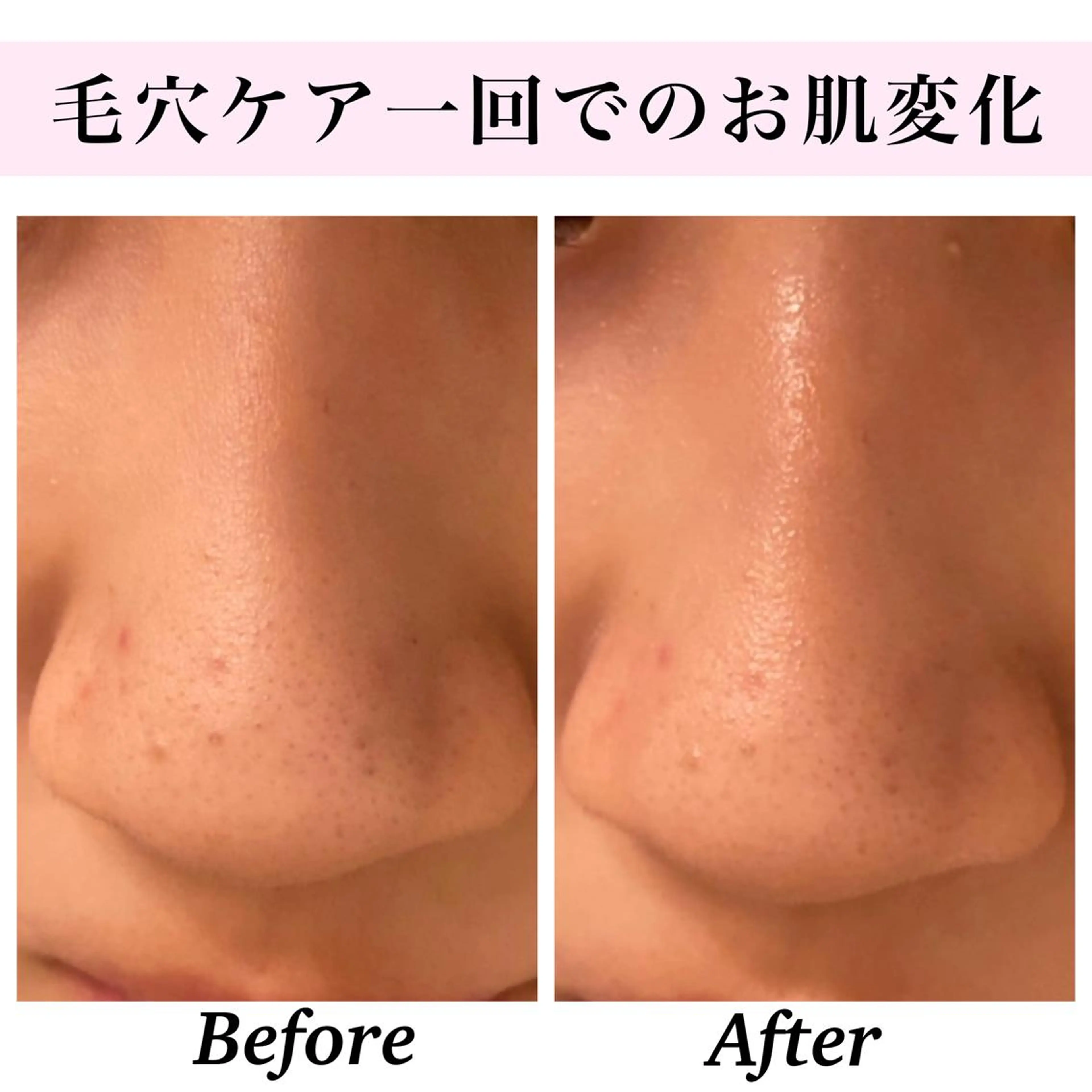 エステ リラク Bellesthe （ベルエステ）のエステ・リラクイメージ