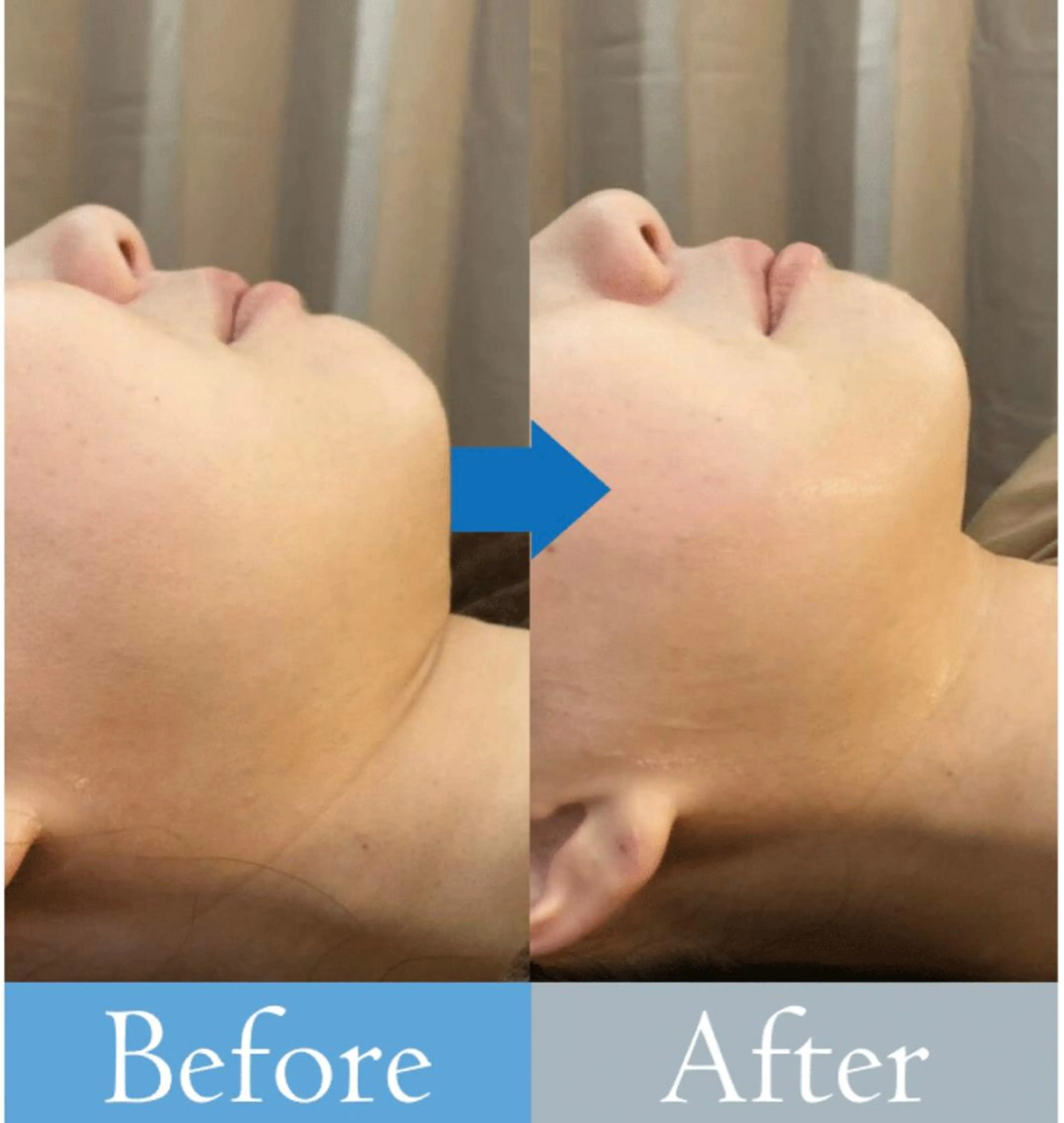 【医療提携エステ】 ルミナス北浦和のその他イメージ