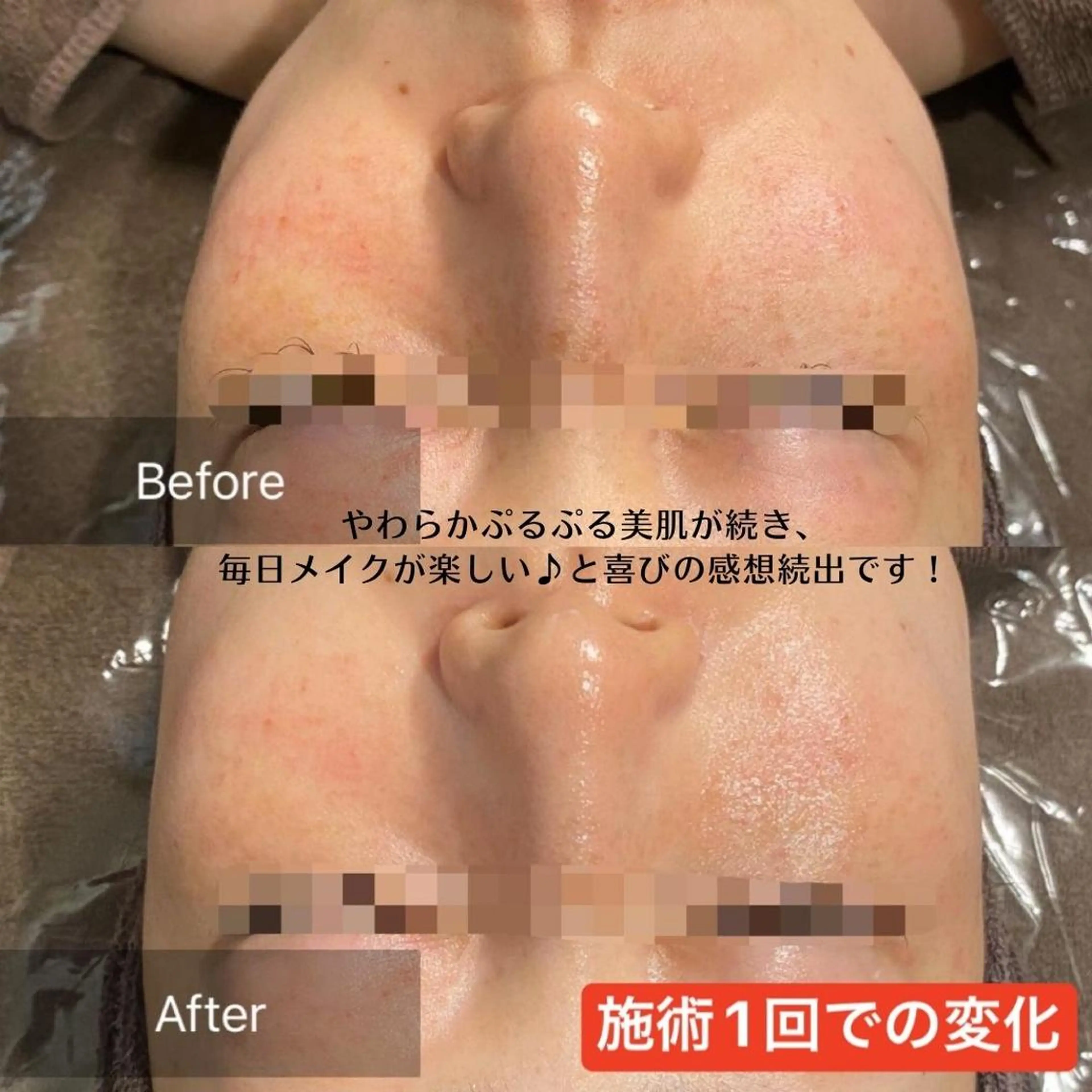 ビューティースリム reborn 新宿店のエステ・リラクイメージ