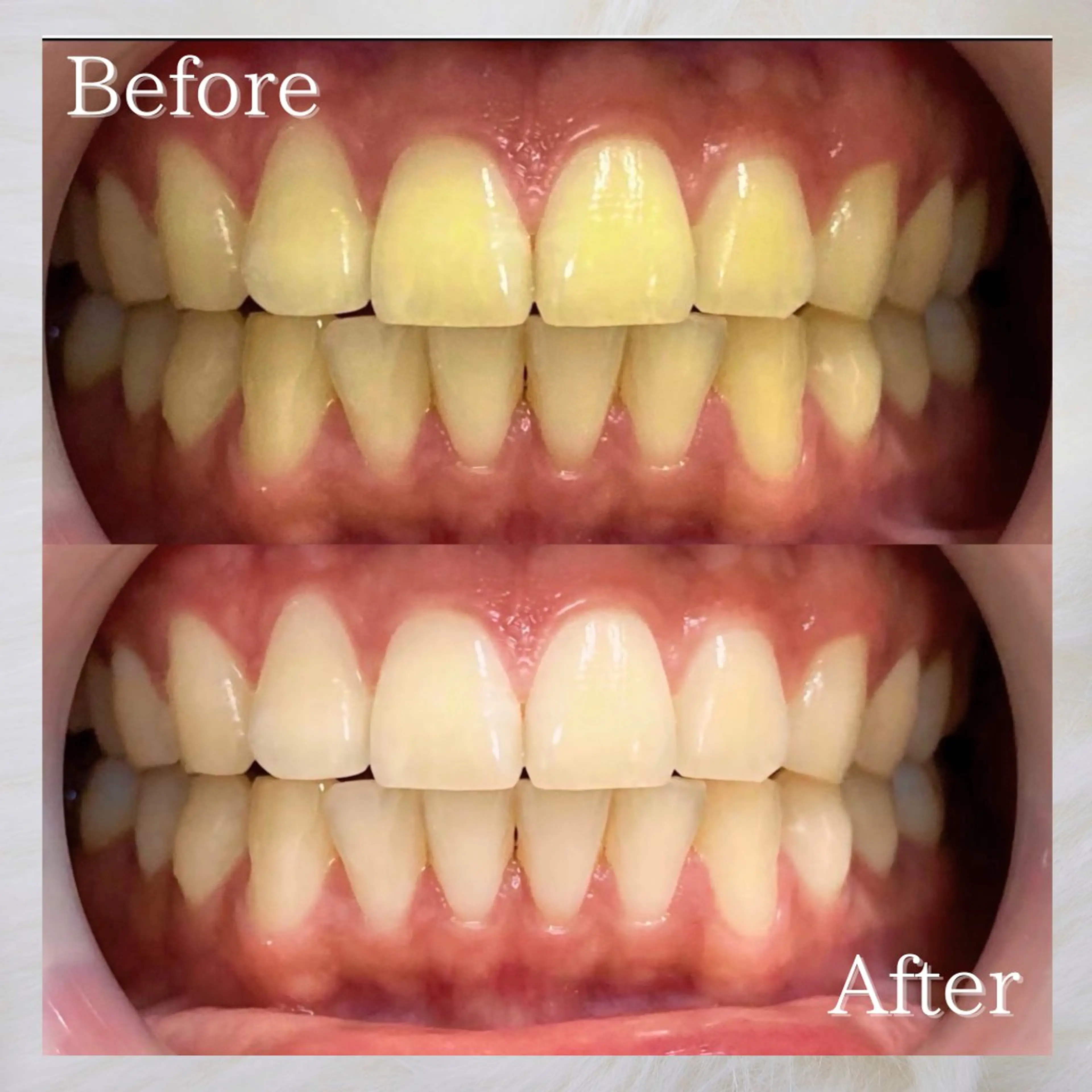 LBSホワイトニング 🌐岡山店のその他イメージ