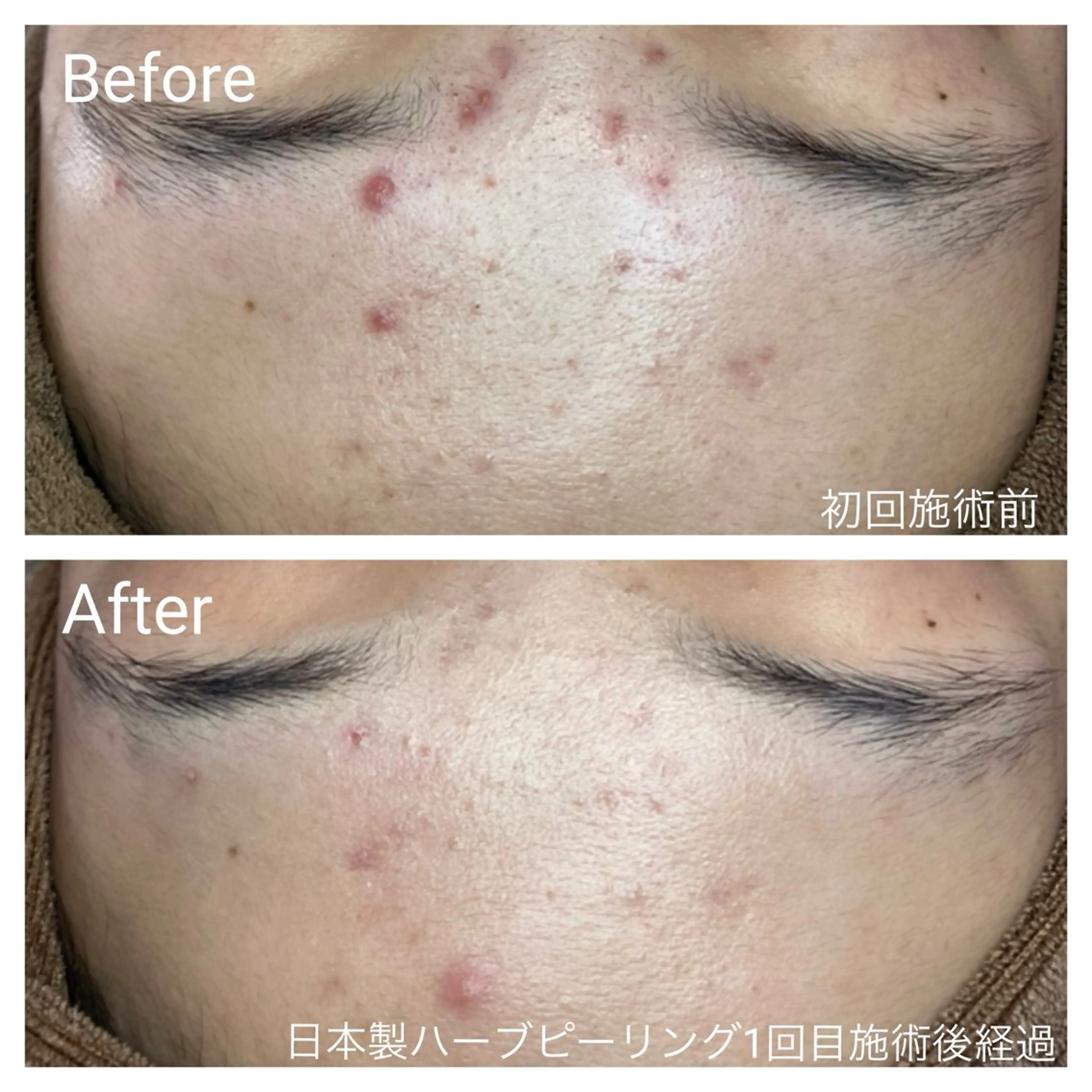 エステ リラク 深い肌悩み&早期脱毛 完了サロンのエステ・リラクイメージ