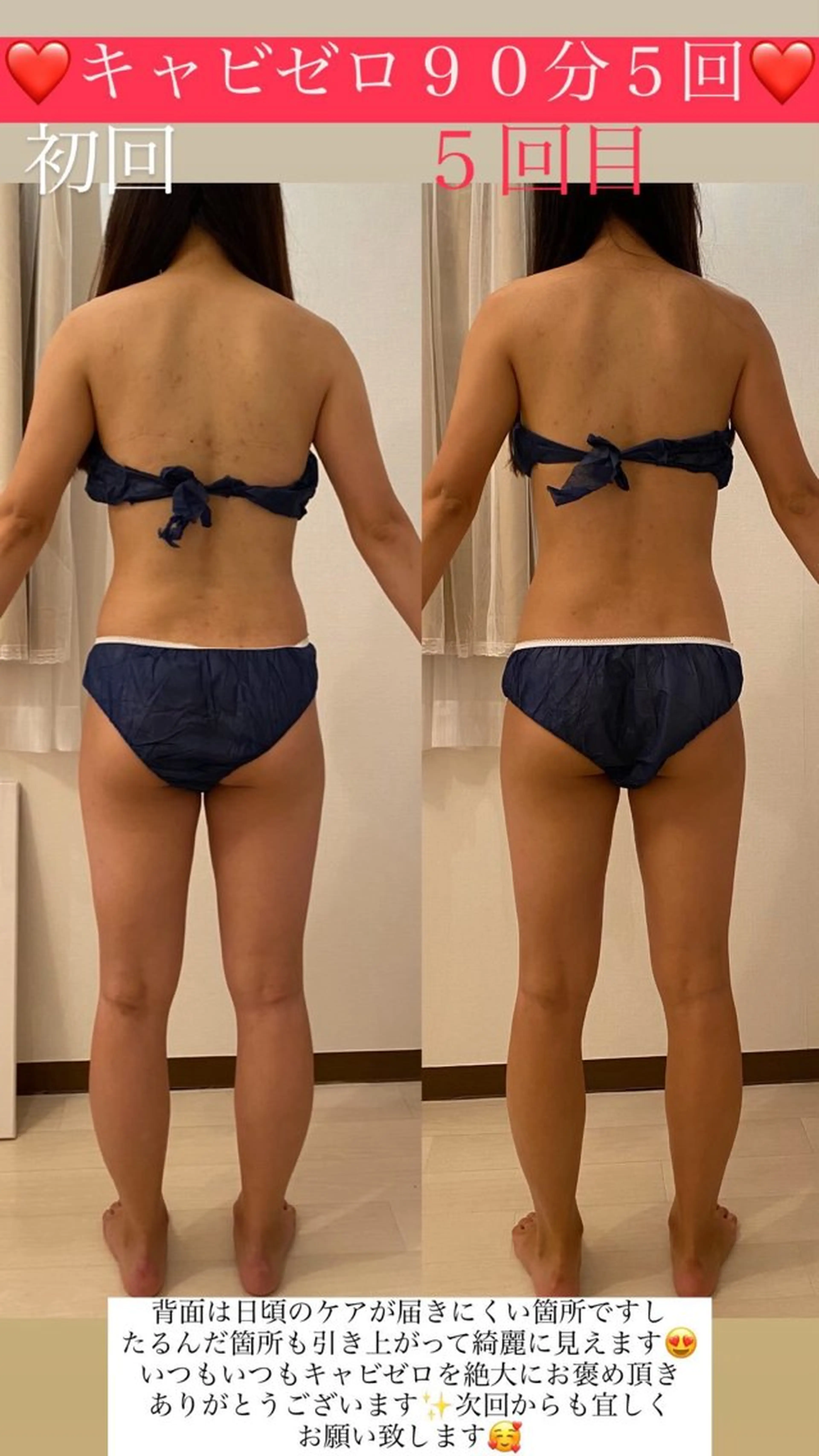 エステ リラク Salon de Lino 御器所のエステ・リラクイメージ