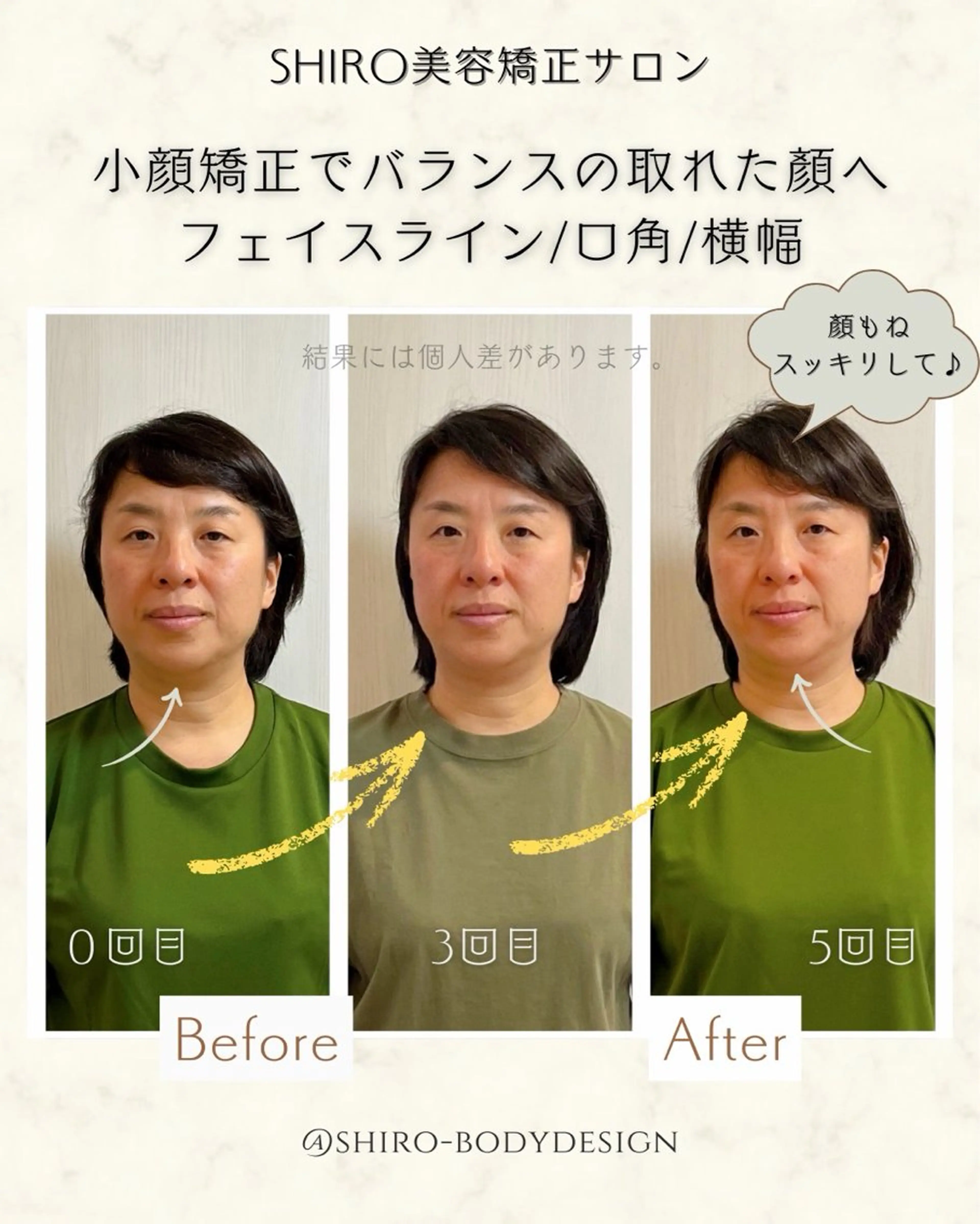 小顔矯正勝山式 shiroしろのエステ・リラクイメージ
