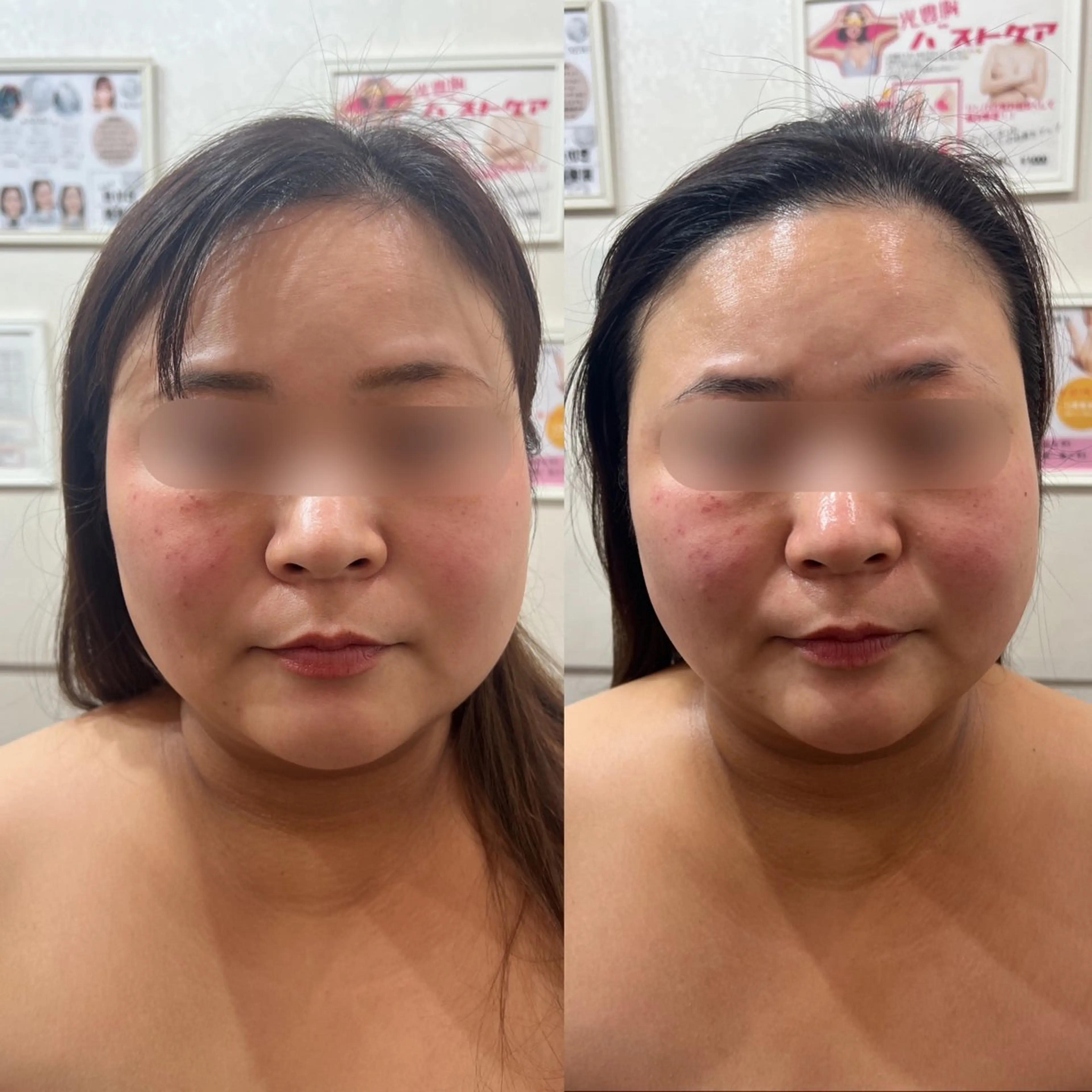 小顔リンパマッサージエステ(クレンジング＋イオン導入付)の写真