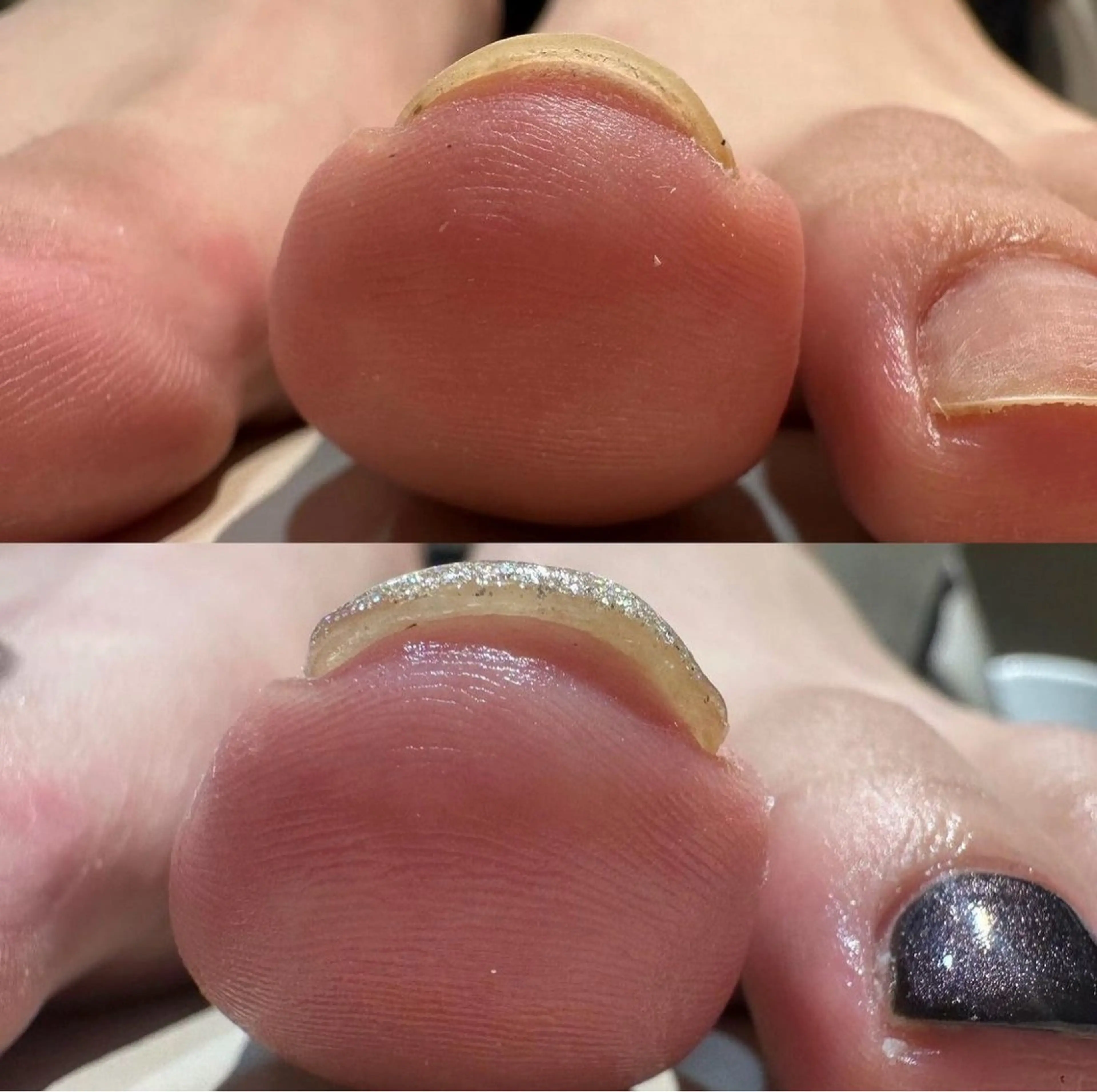 ネイル ジェルネイル 韓国ネイル フットネイル レナークアリア ネイリスト高橋のネイルデザイン