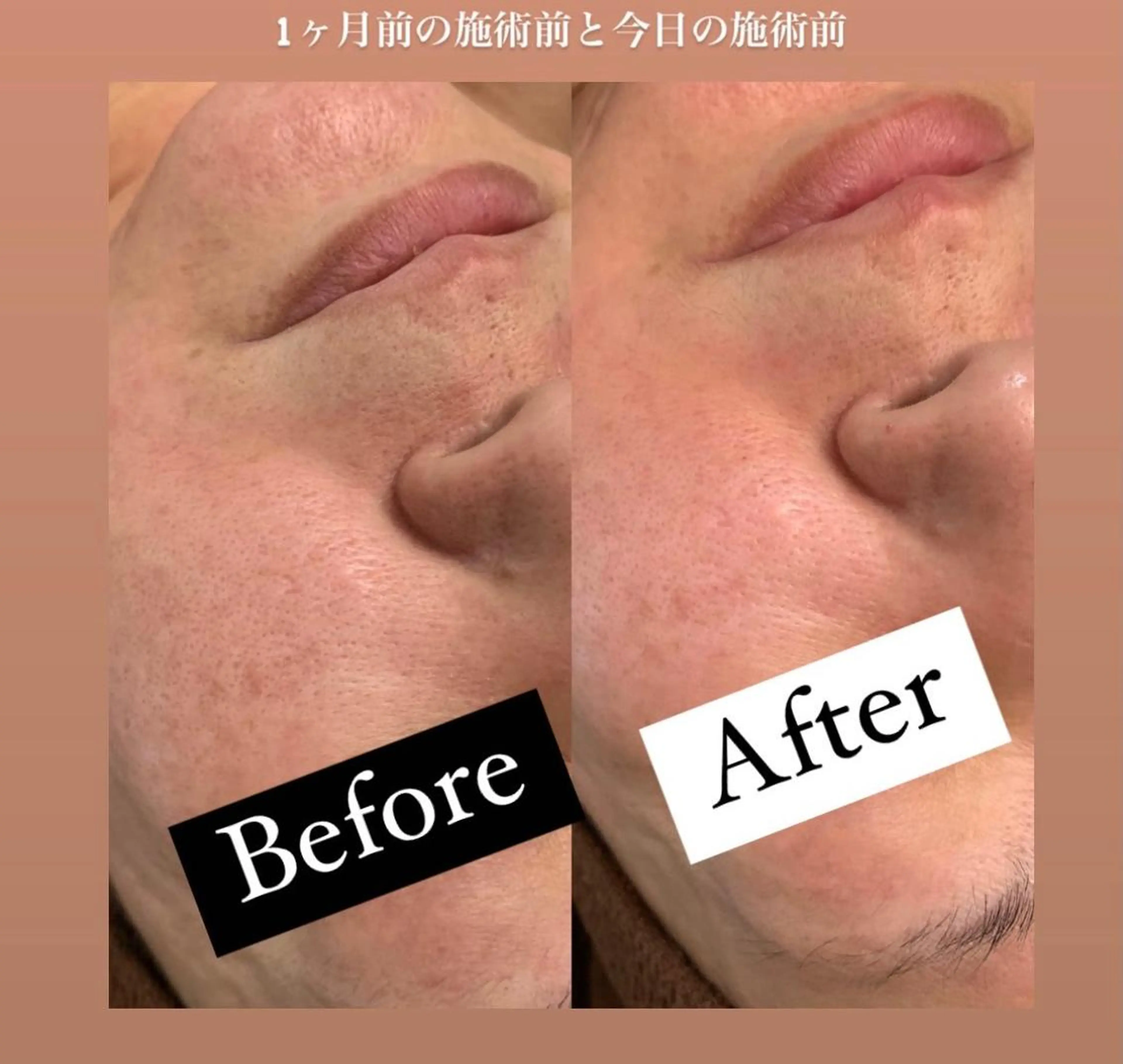 R.M所属・プライベートサロン R.Mのエステ・リラクイメージ