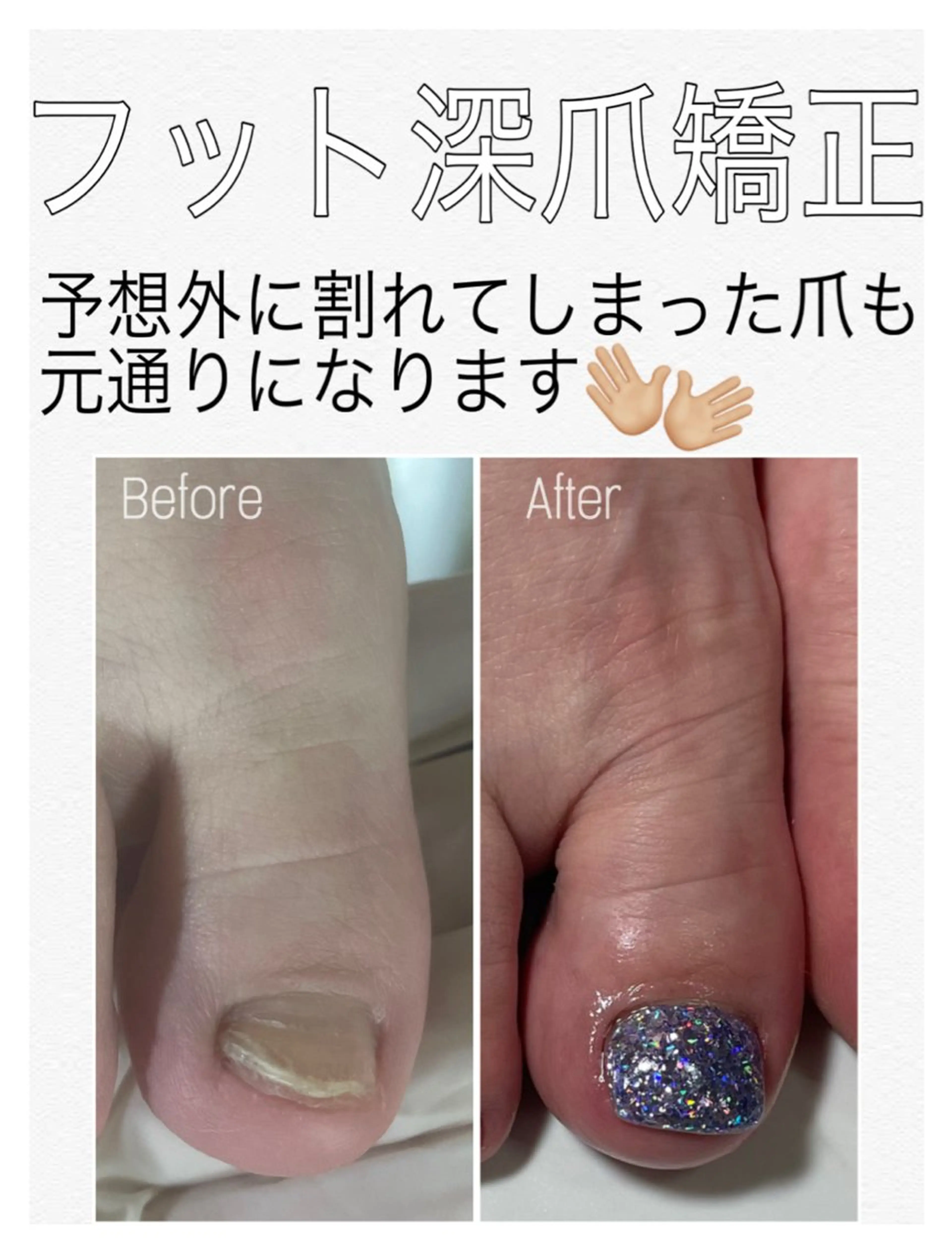 ネイル フットネイル フットネイル nail salon petillantのネイルデザイン