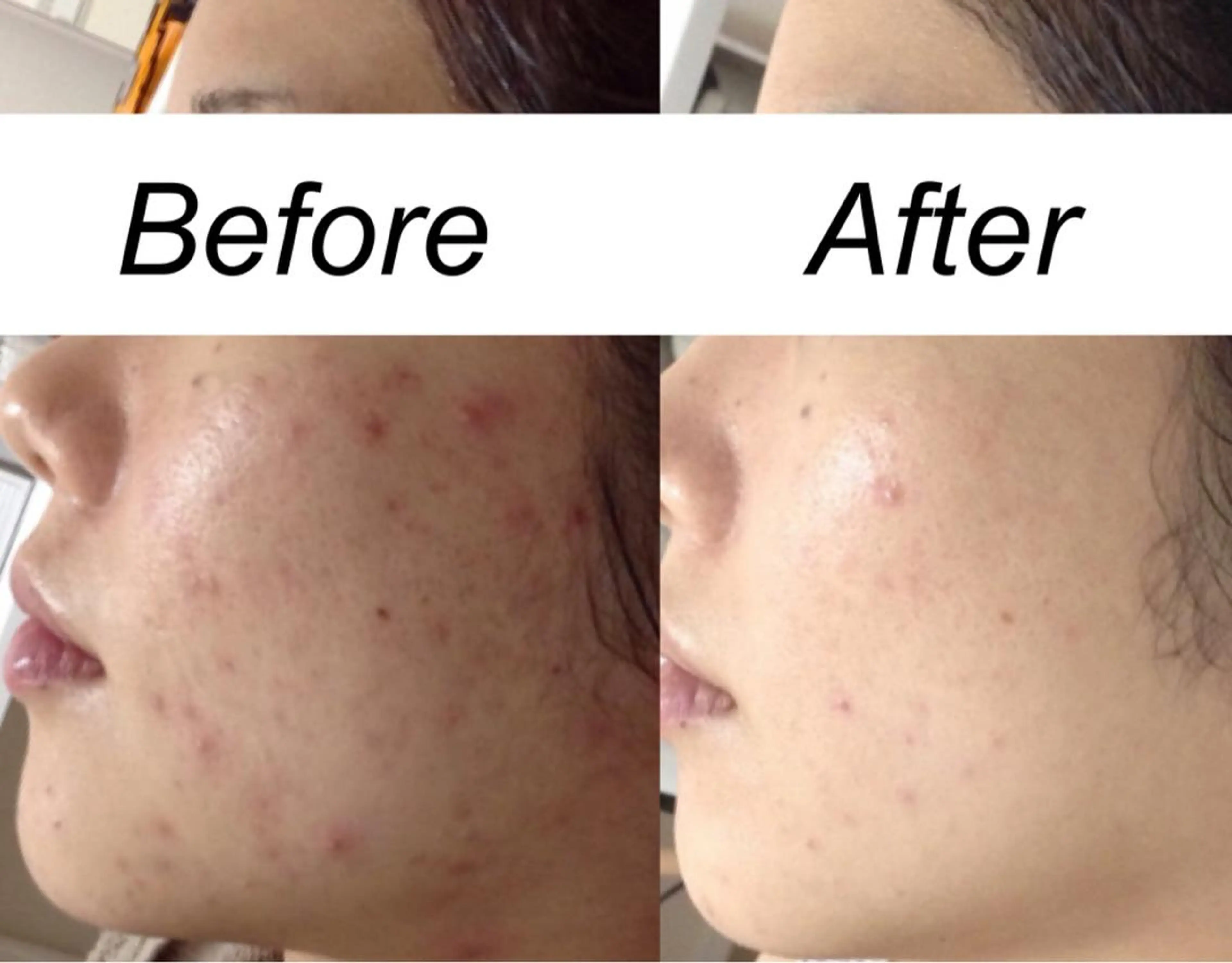 ミディアム カラー パーマ ヘアアレンジ キッズ ネイル マツエク・マツパ エステ リラク 都度払い肌質改善 &脱毛Blancheのエステ・リラクイメージ