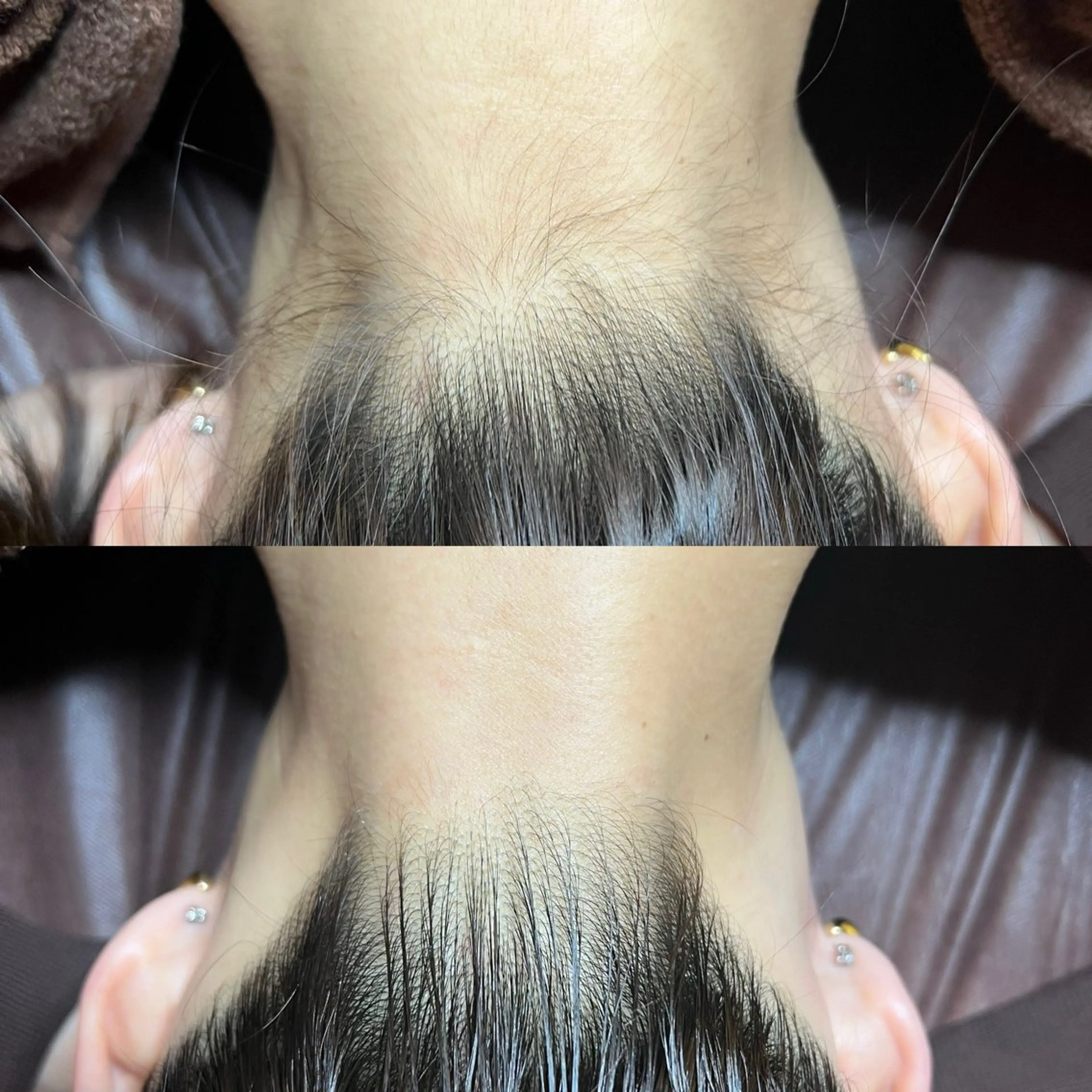 脱毛 GOLDEN AGEのエステ・リラクイメージ