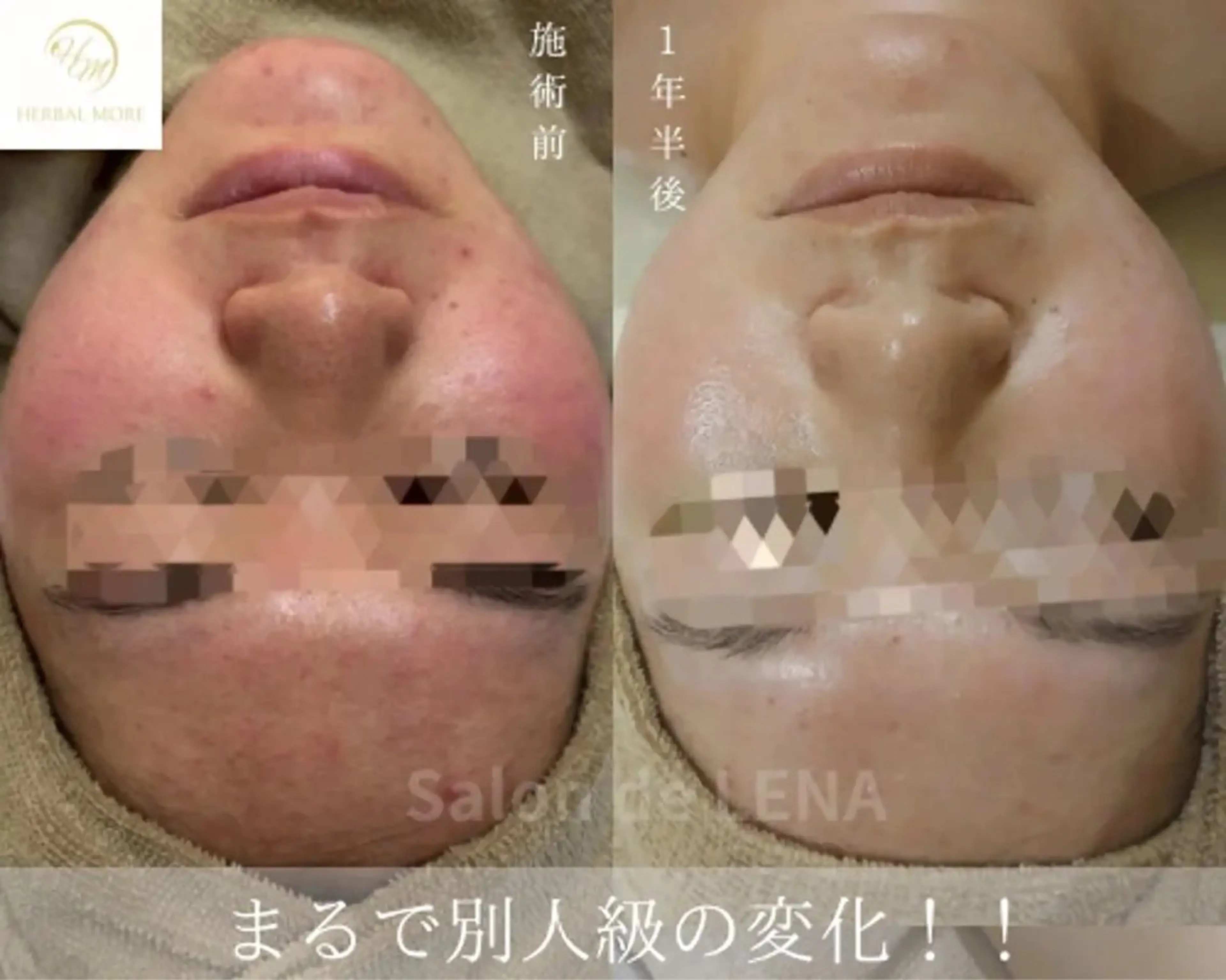 ハーブピーリング専門 グランディール　武内のエステ・リラクイメージ