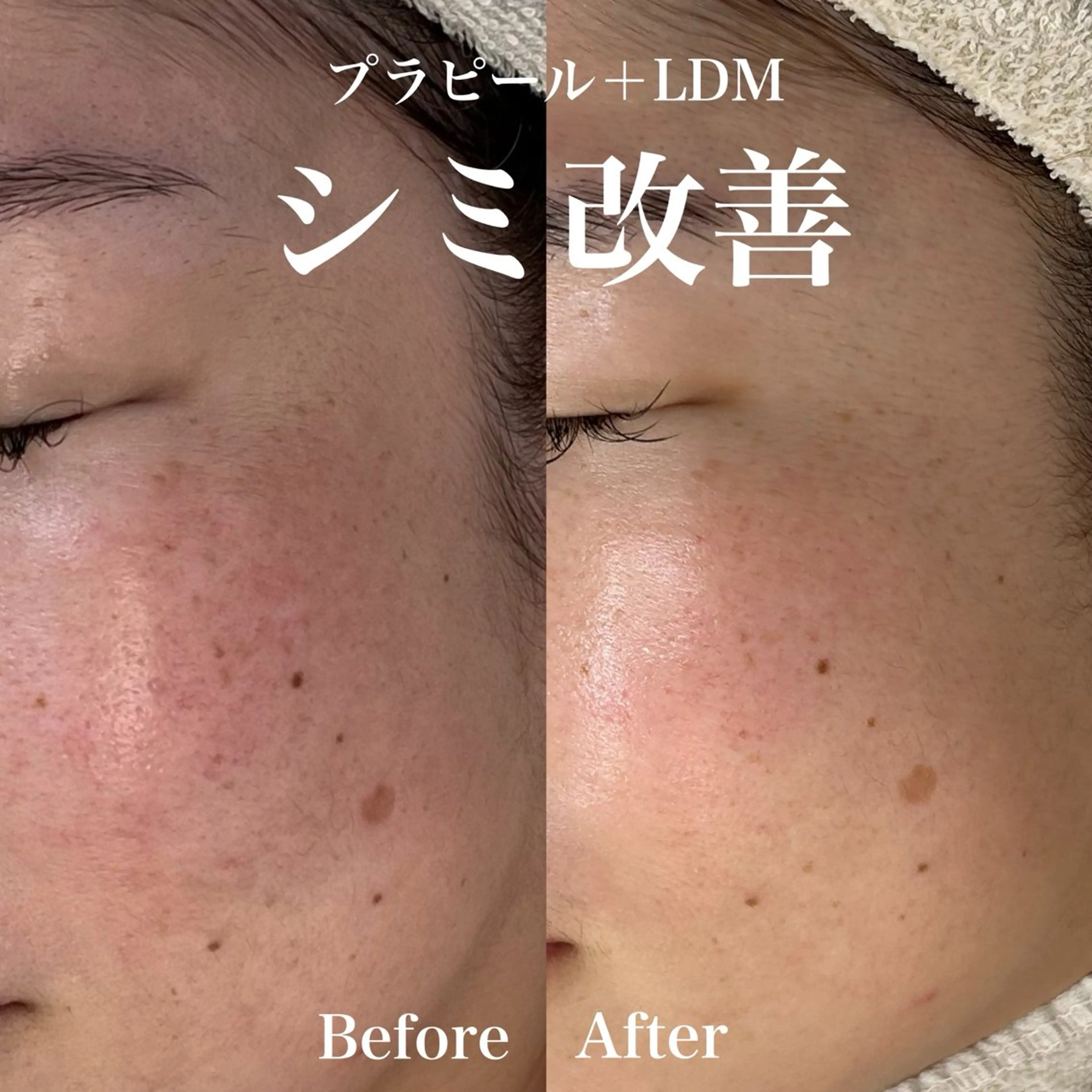 韓国肌管理&小顔 ＩＲＯＨＡのエステ・リラクイメージ