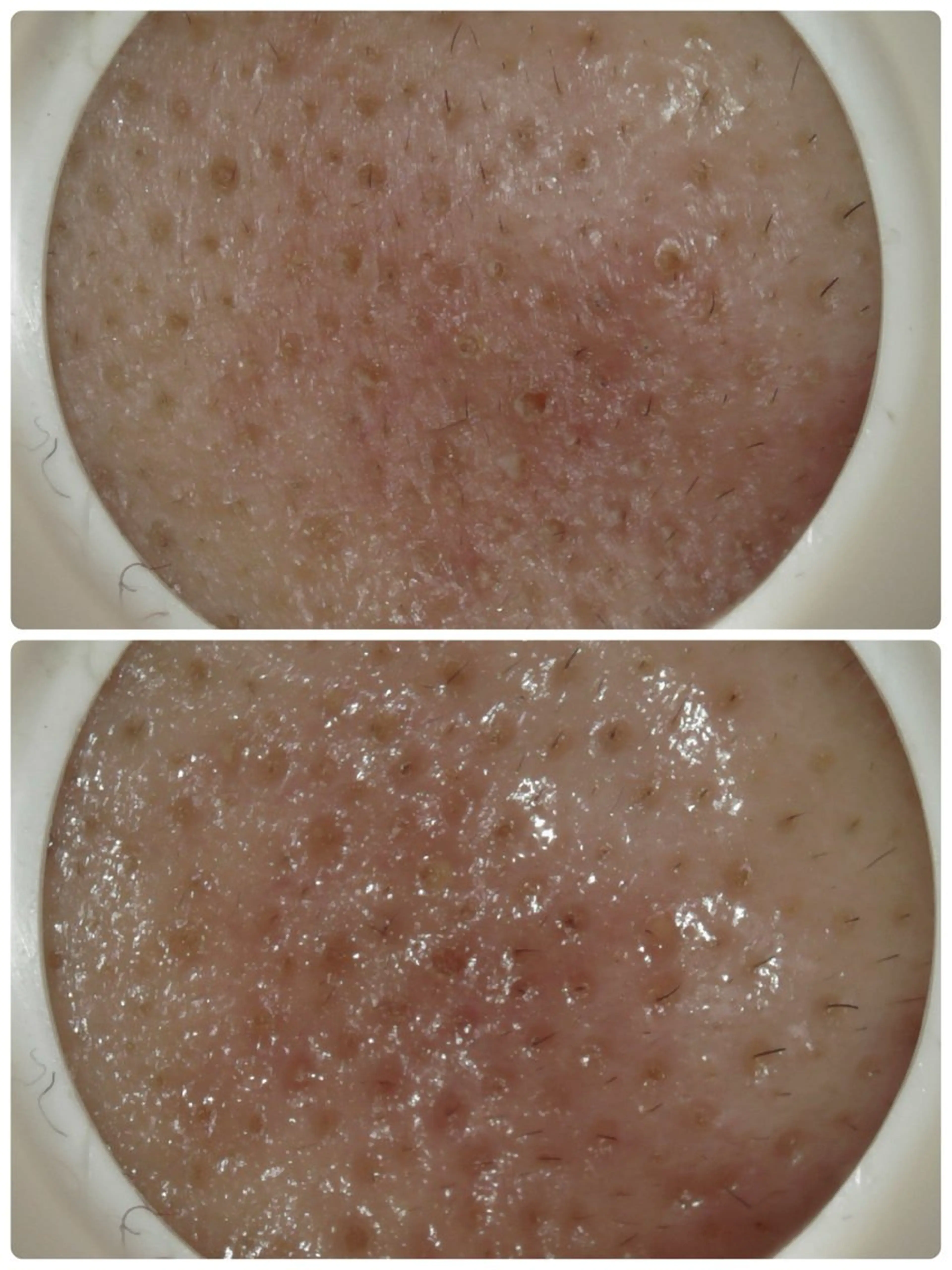 エステ リラク メナード片町 やまもと みくのエステ・リラクイメージ