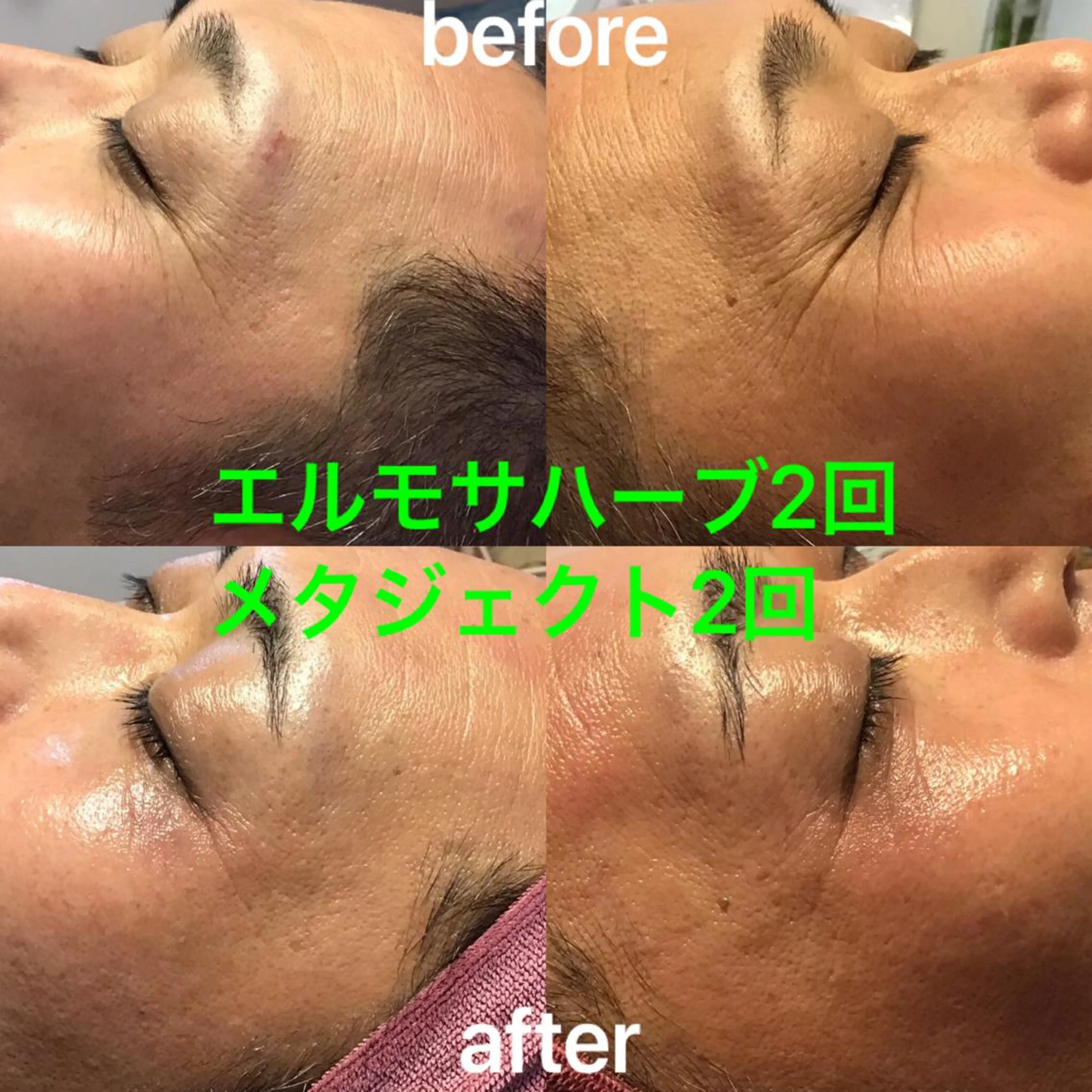 エステ 松下 さゆりのエステ・リラクイメージ